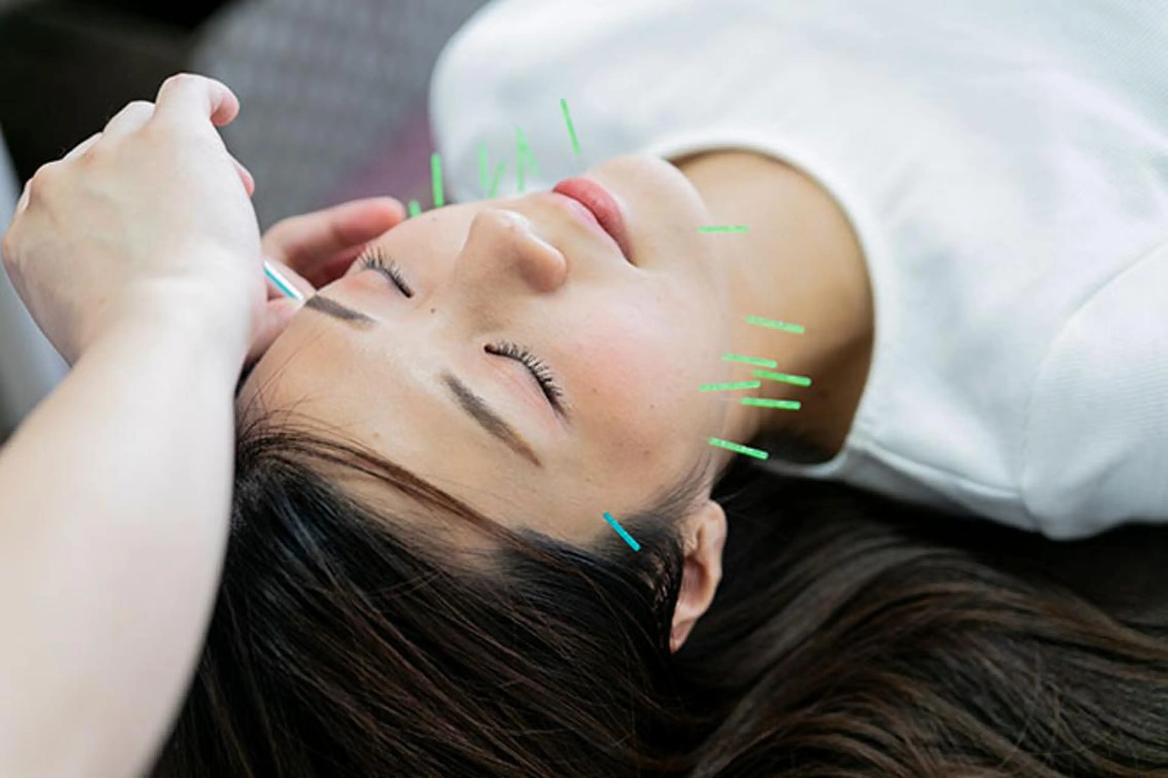 エステ リラク 同心整骨院 美容鍼・整体・小顔のエステ・リラクイメージ