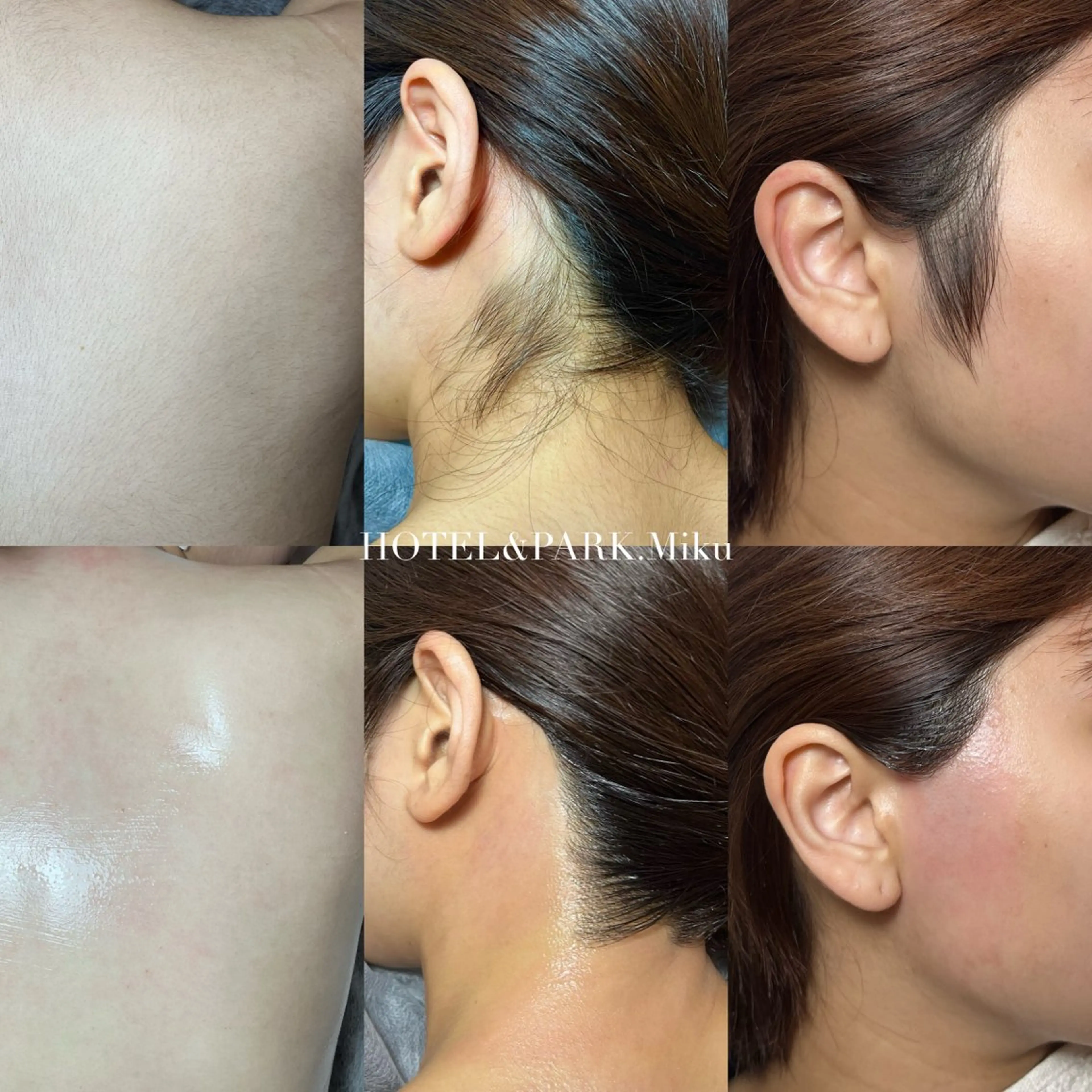 HOTEL&PARK . ワックス脱毛のエステ・リラクイメージ