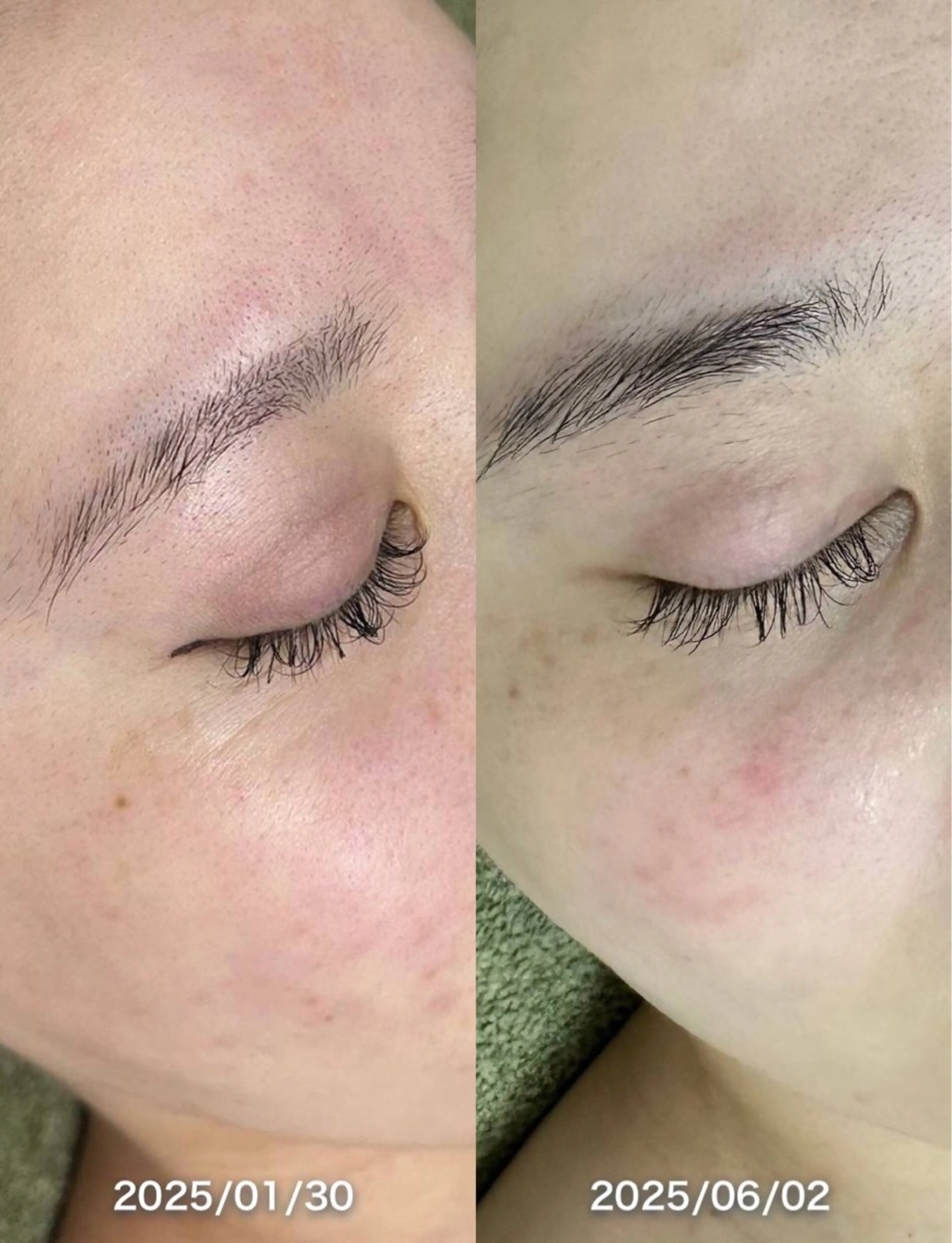 韓国美肌/肌質改善 【天神】yuiのエステ・リラクイメージ