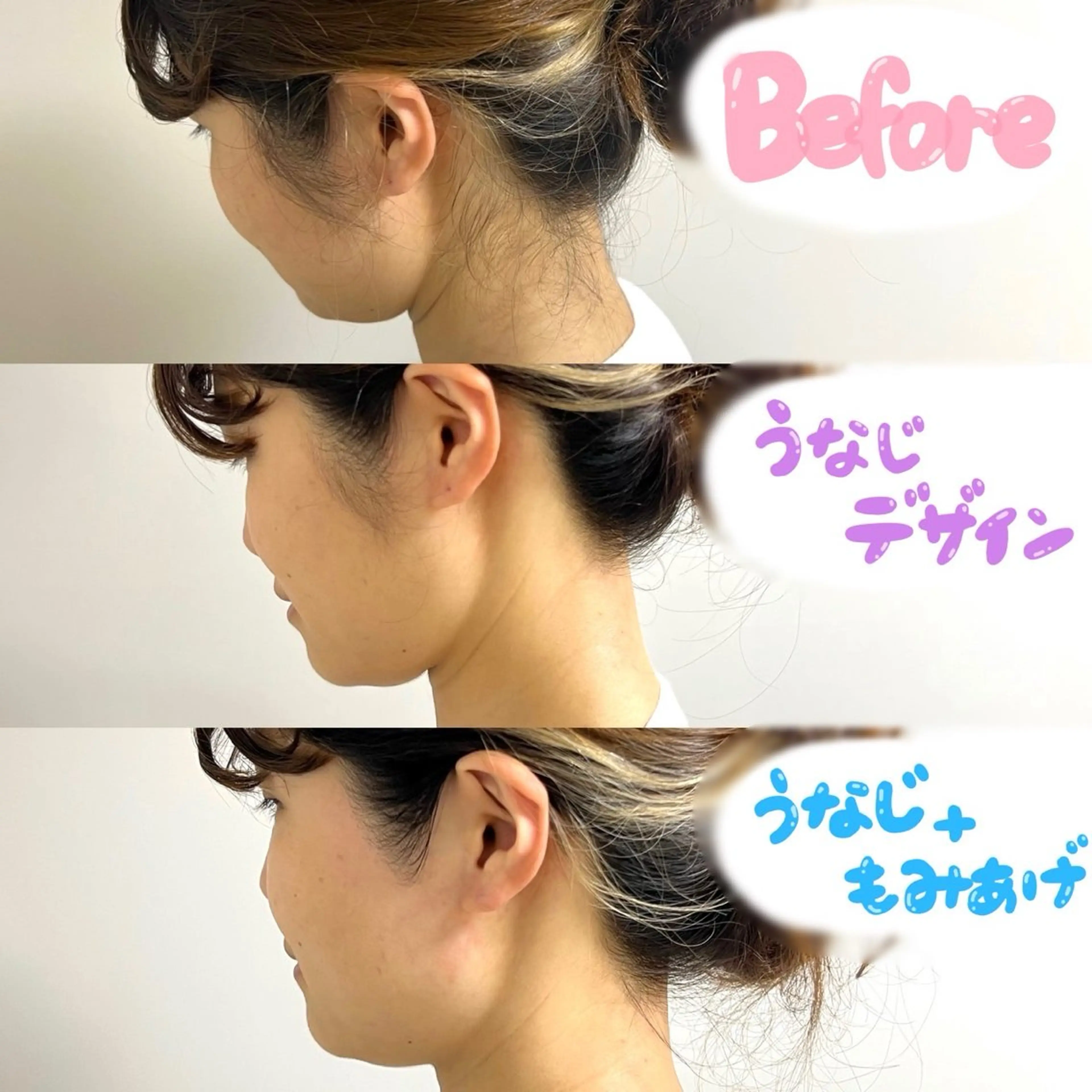 【無料】※概要よくご覧ください11/4(火)16:30🌈うなじ脱毛🌈シュガーリング＋光脱毛の写真