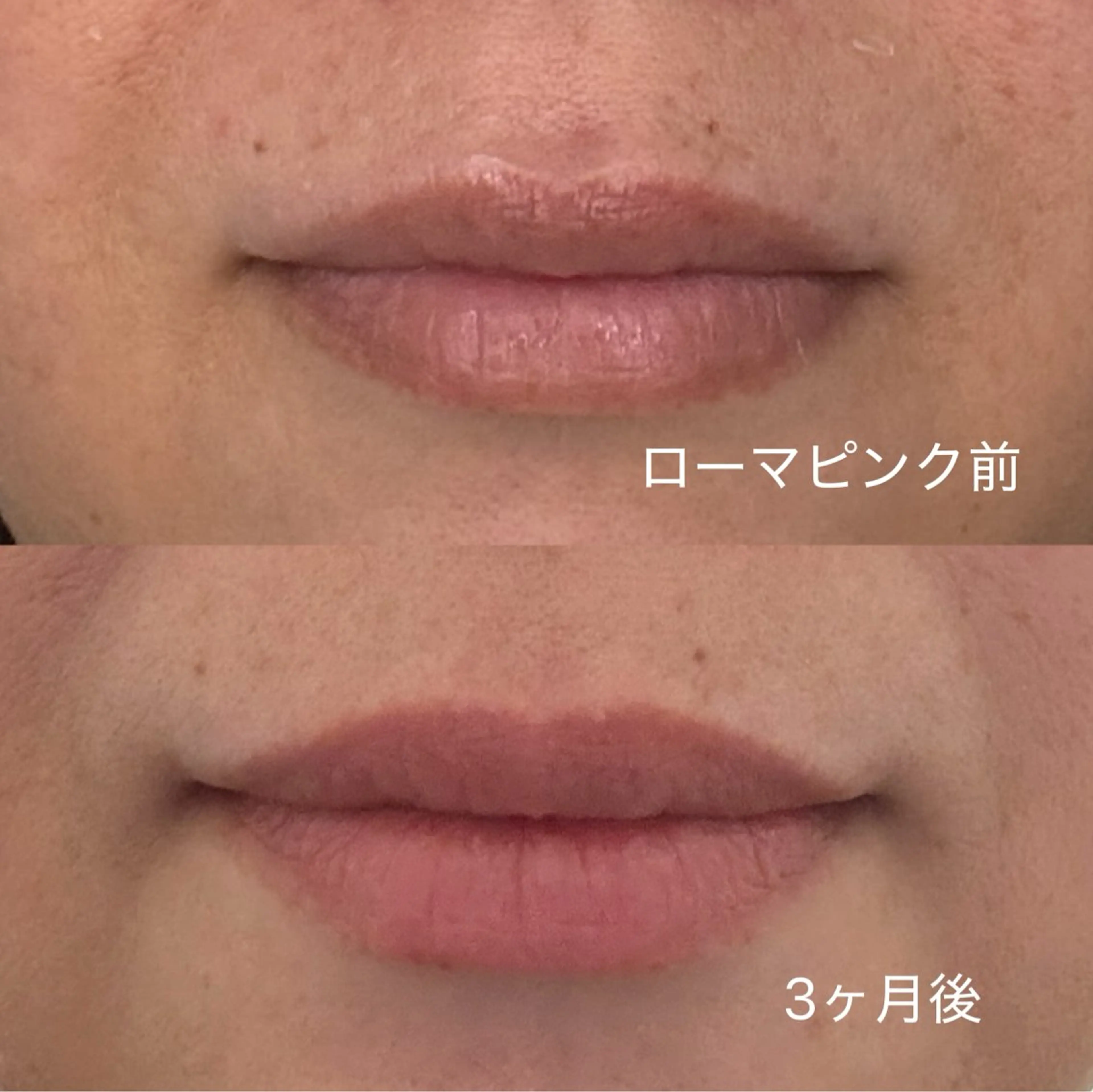 エステ 肌質改善サロンand...所属・肌質改善サロン and...のエステ・リラクイメージ