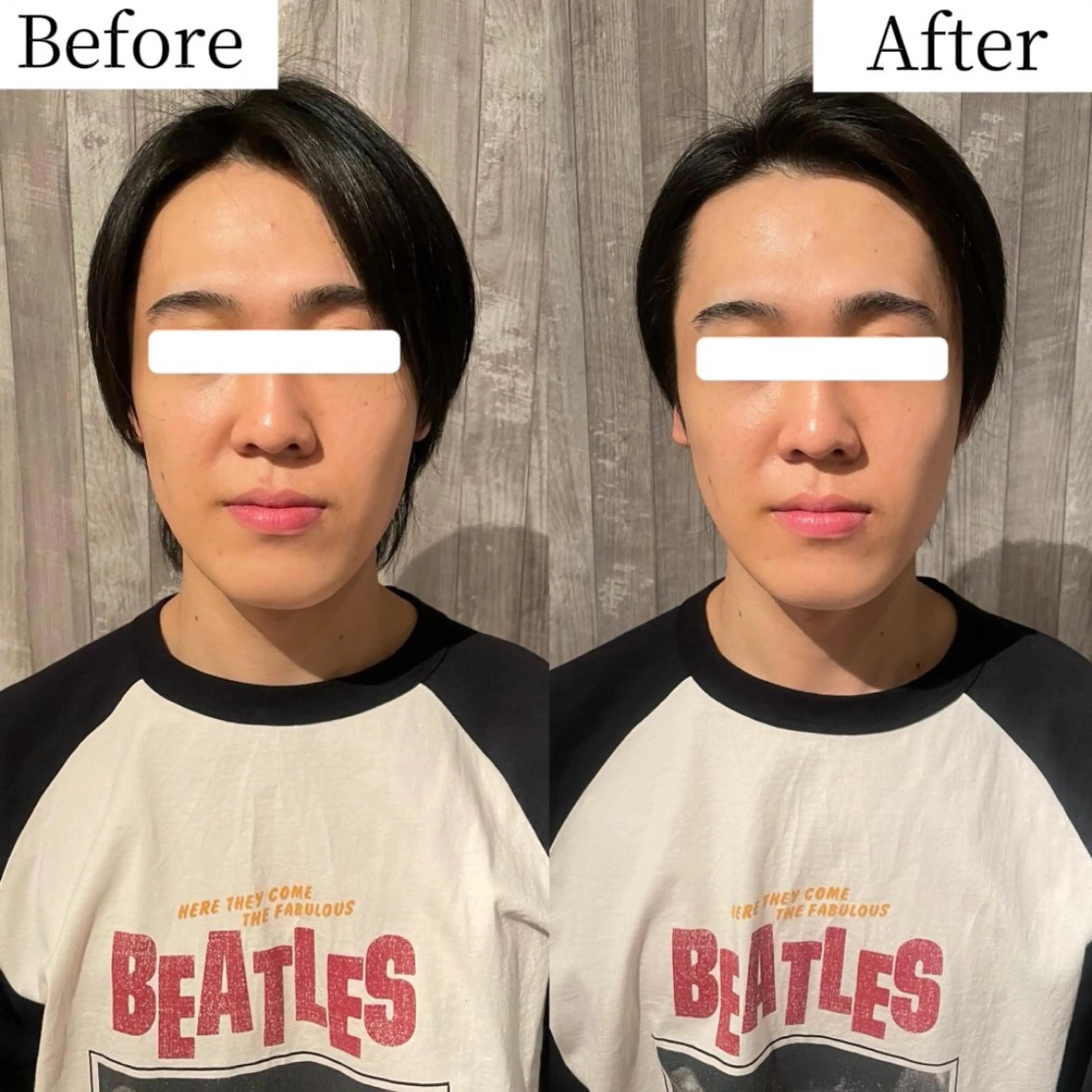 メンズ グレースフィオーレ上野御徒町店所属・頭蓋骨小顔矯正 上野御徒町店*かんなのエステ・リラクイメージ