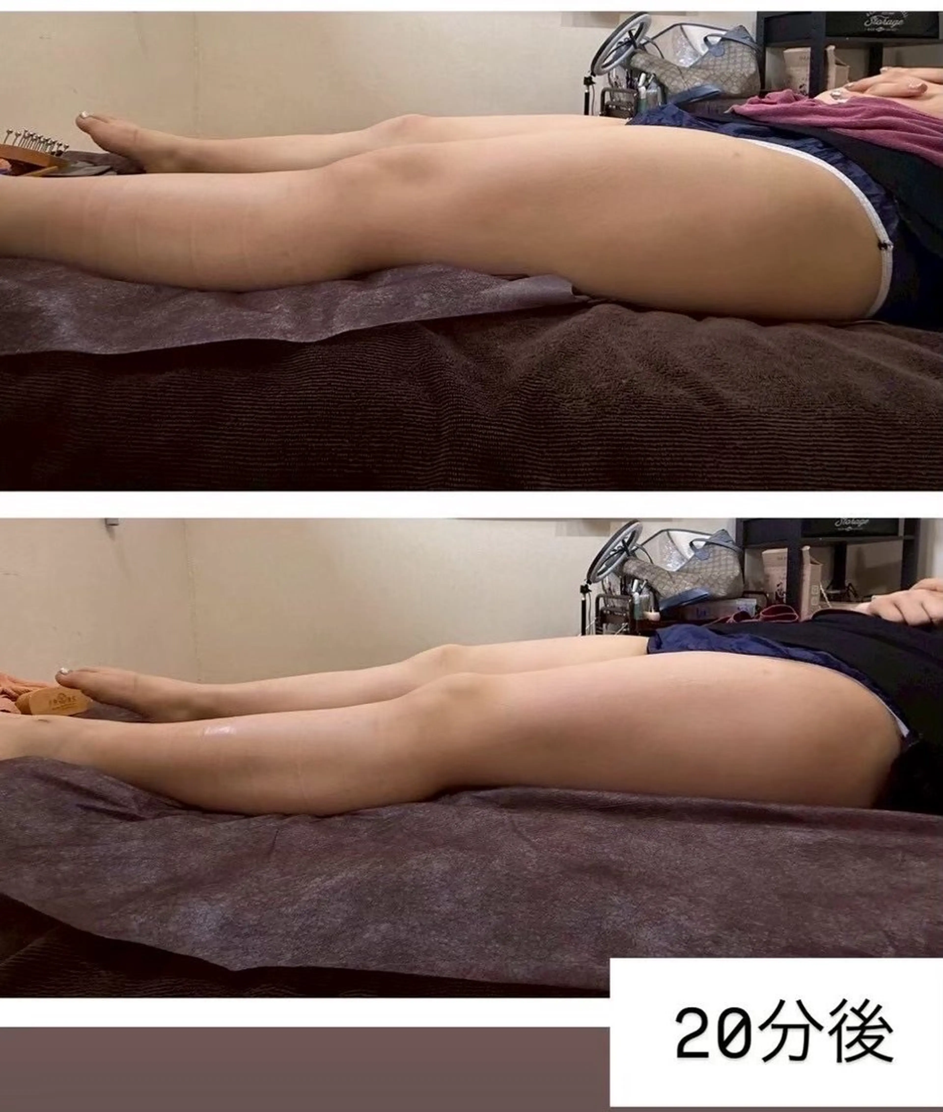 🎗️足やせ専科🎗️美脚45分コース　パンパンな足をスペシャルカッサでほぐし流すことで、体液循環を促します🔄の写真