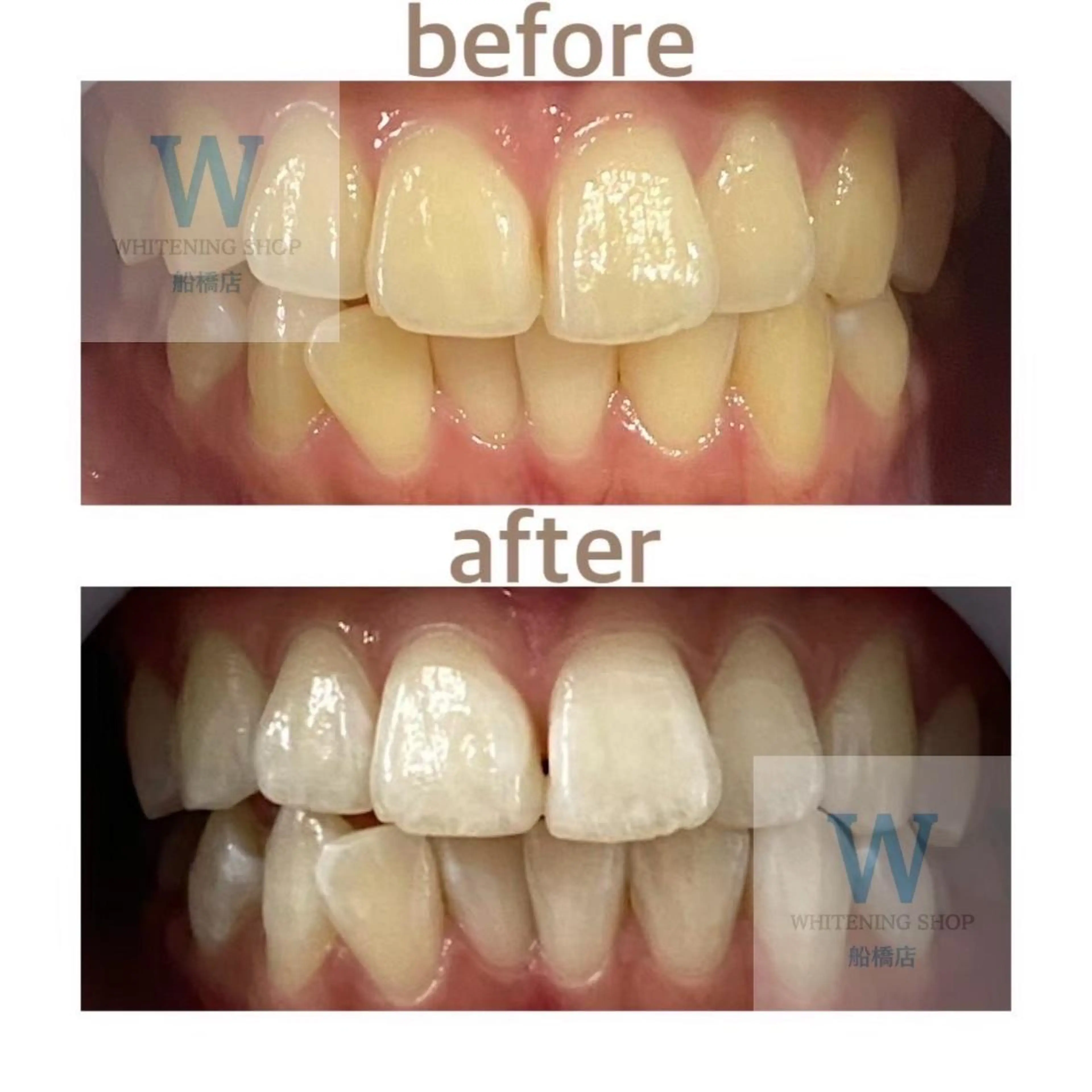 エステ リラク ホワイトニング ショップ船橋店🦷のエステ・リラクイメージ