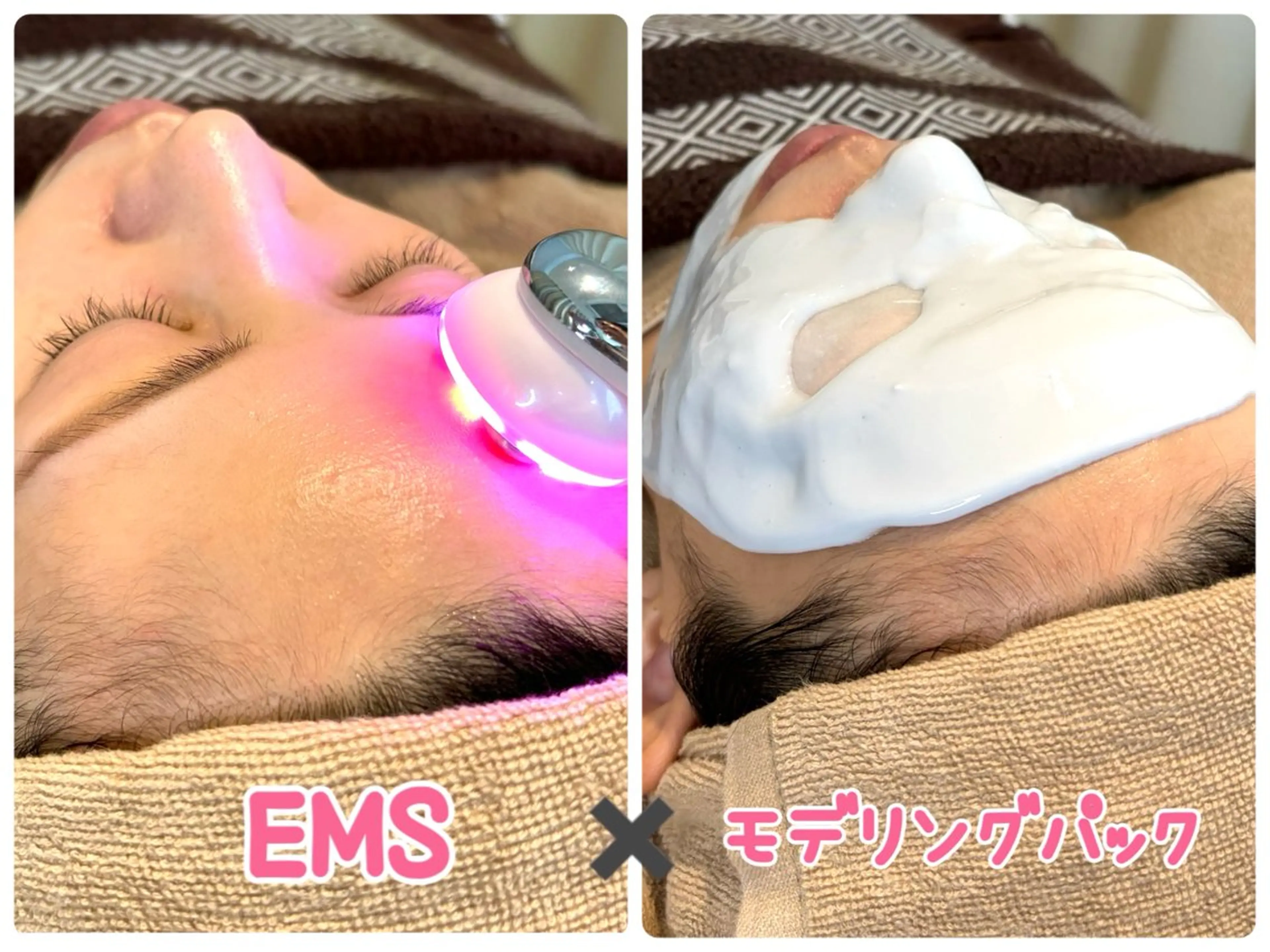 【たるみ・むくみ・小顔効果・乾燥改善✨】EMS幹細胞ポレーション導入＋セラミド配合✨高保湿パック💖💖の写真
