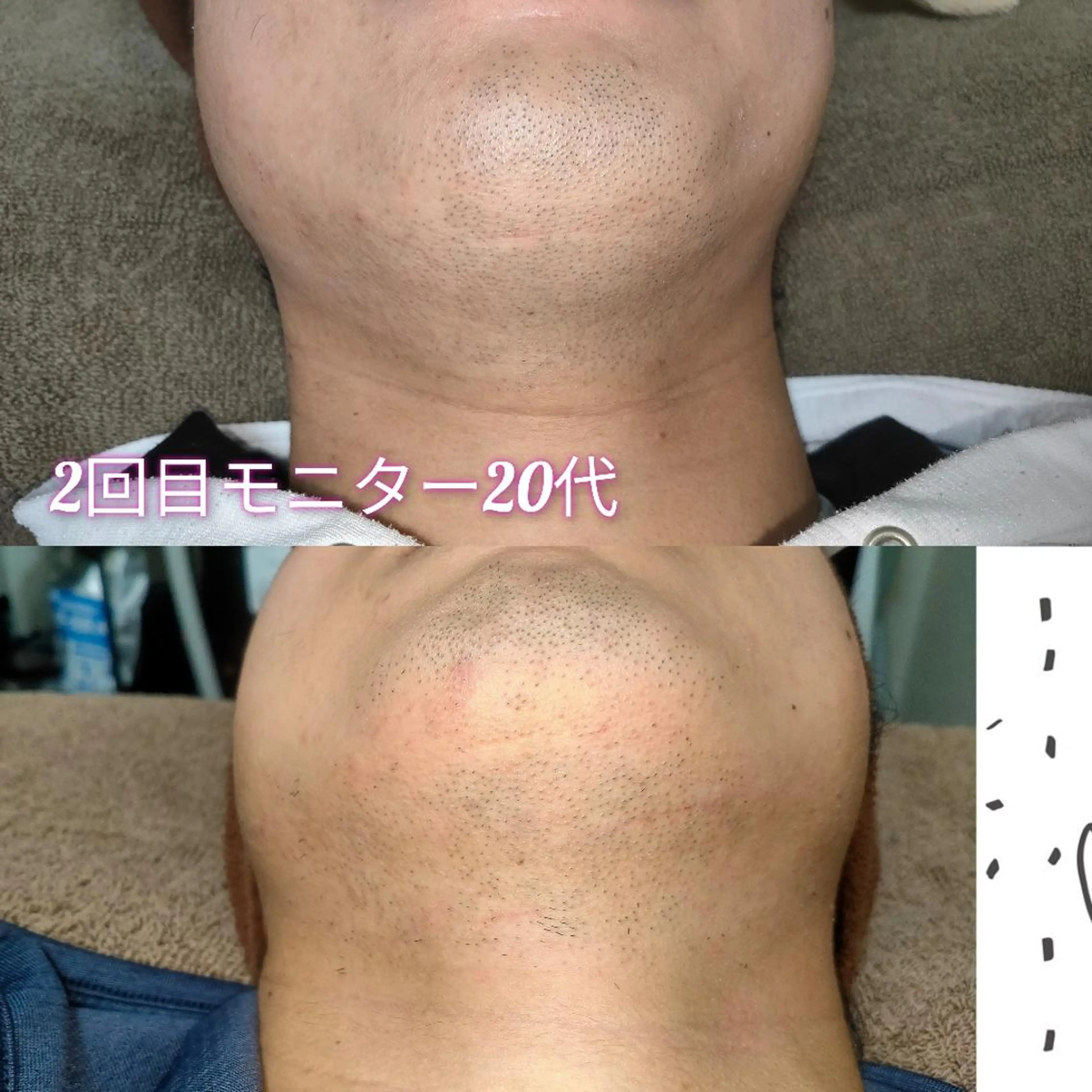 メンズ 脱毛 武 藤のエステ・リラクイメージ