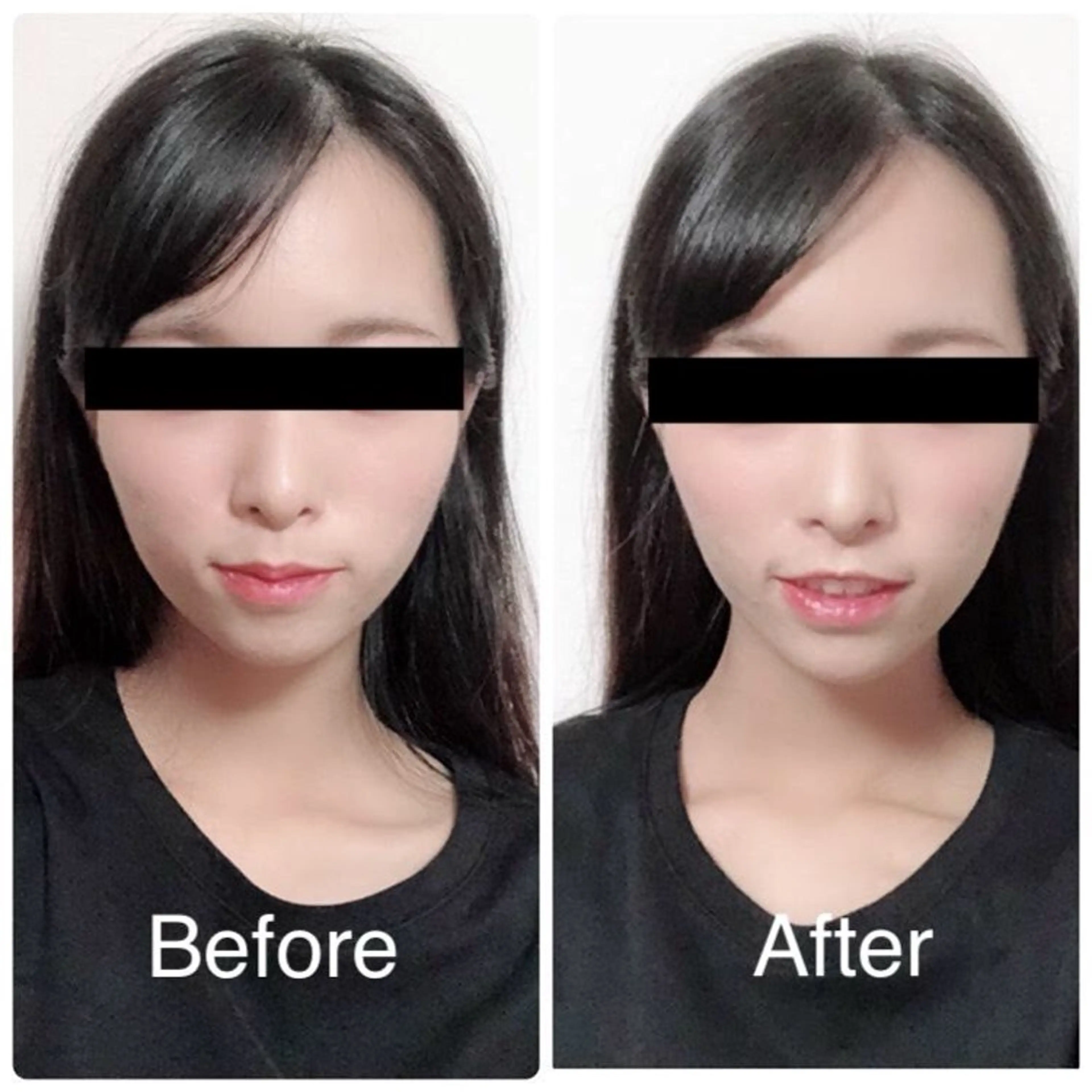 エステ リラク 美容整体Peaks 【姿勢/骨盤/美脚】のエステ・リラクイメージ