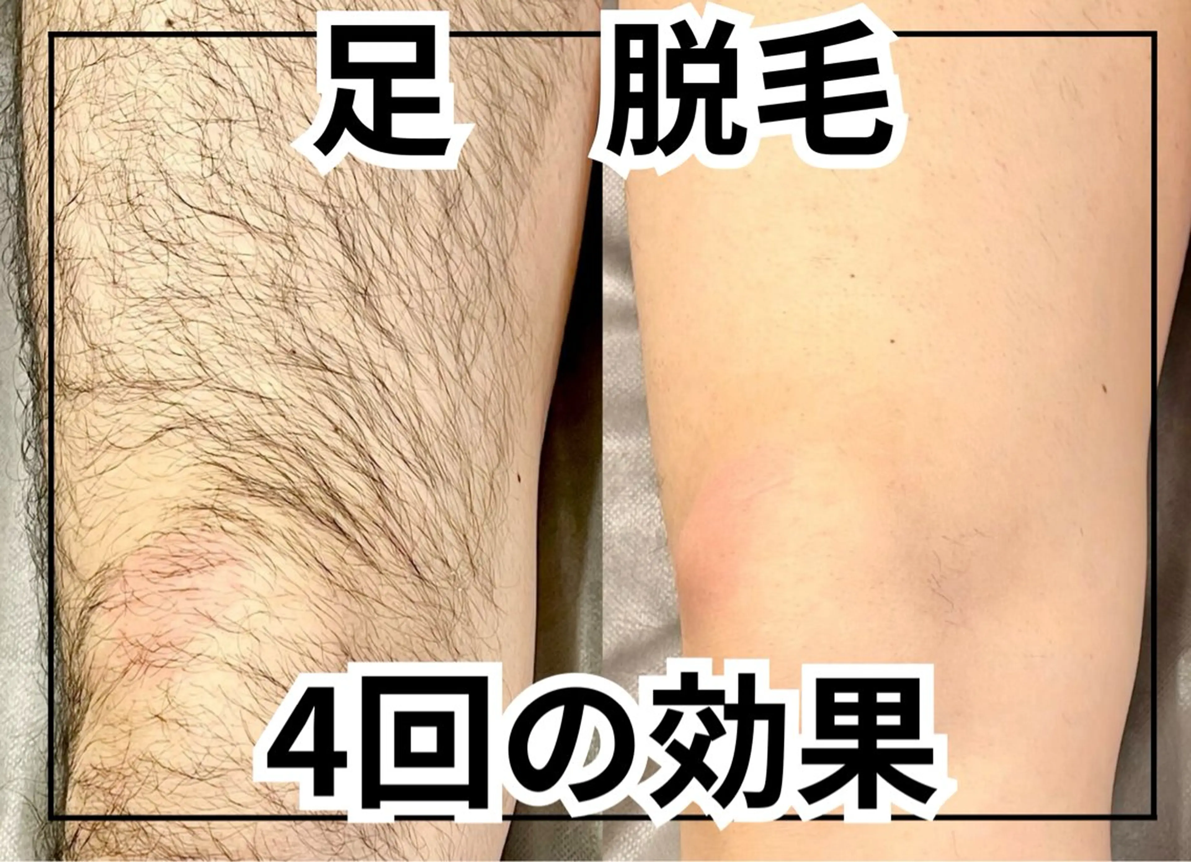 脱毛サロン&ハーブピーリングFIS武蔵小杉店所属・脱毛サロン FIS武蔵小杉店のエステ・リラクイメージ