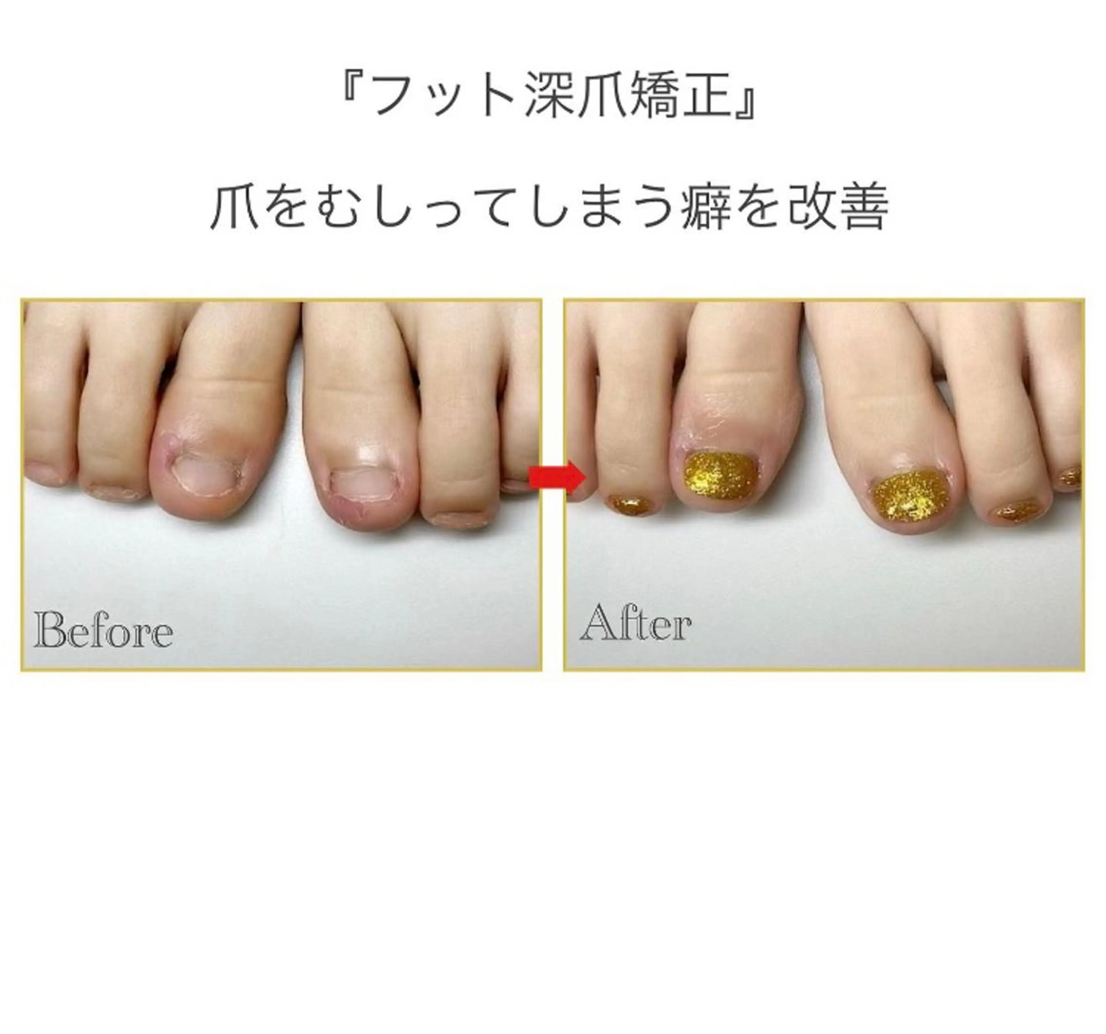 ネイル フットネイル ネイルサロンアリューム所属・ネイルサロン アリュームのネイルデザイン