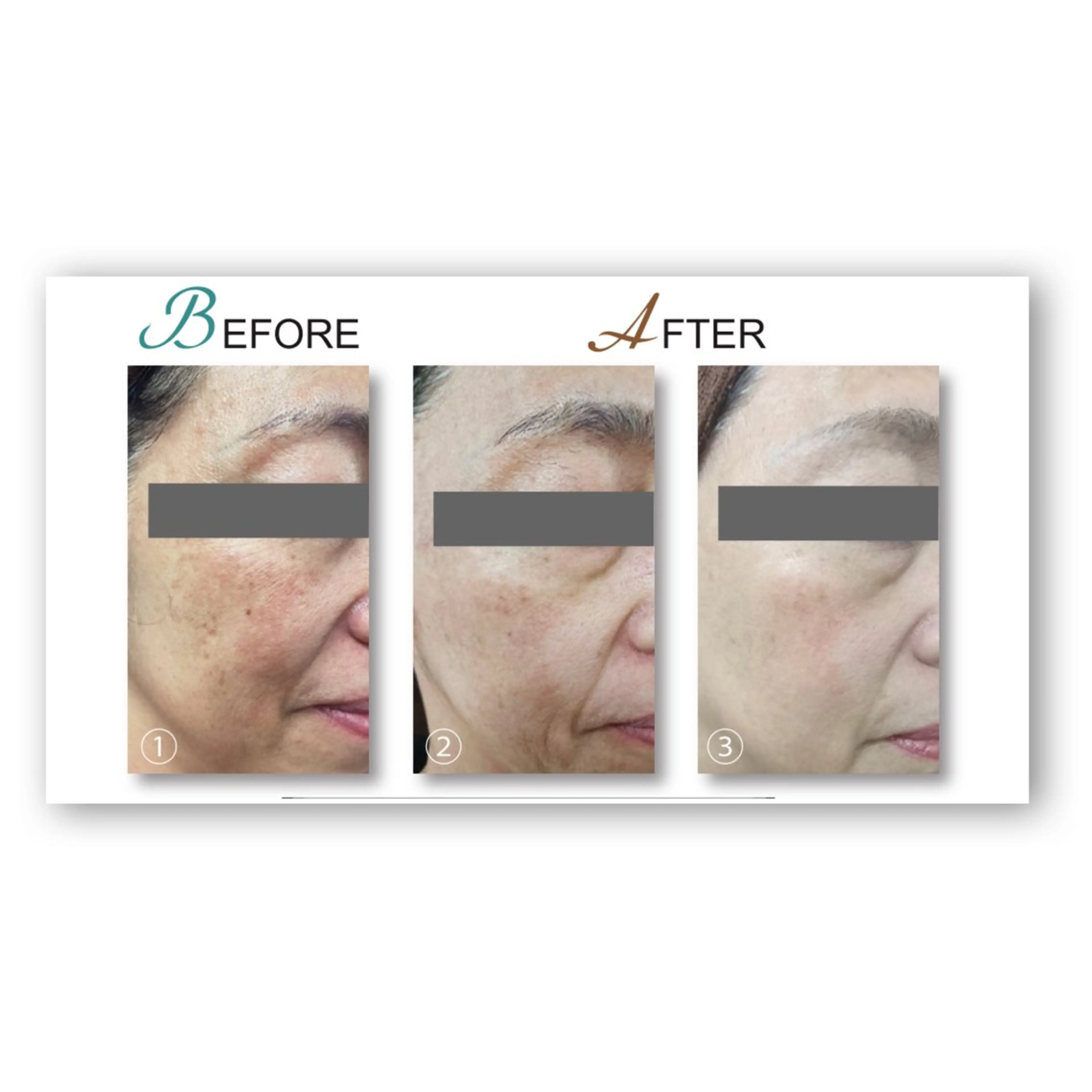 NAYU/レディース 眉毛/堺筋本町の眉毛・アイブロウイメージ