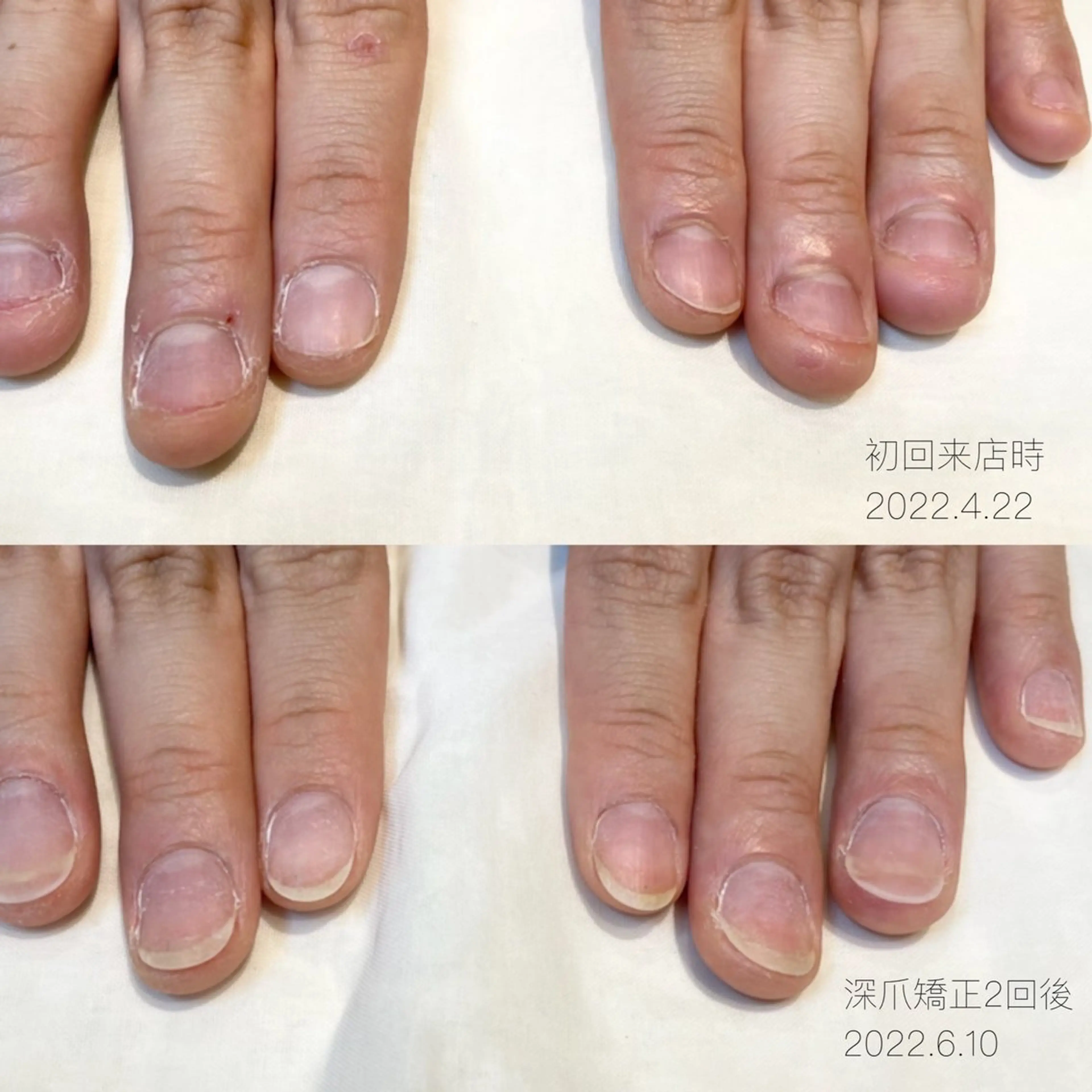 ネイル Terra 池袋 mikiのネイルデザイン