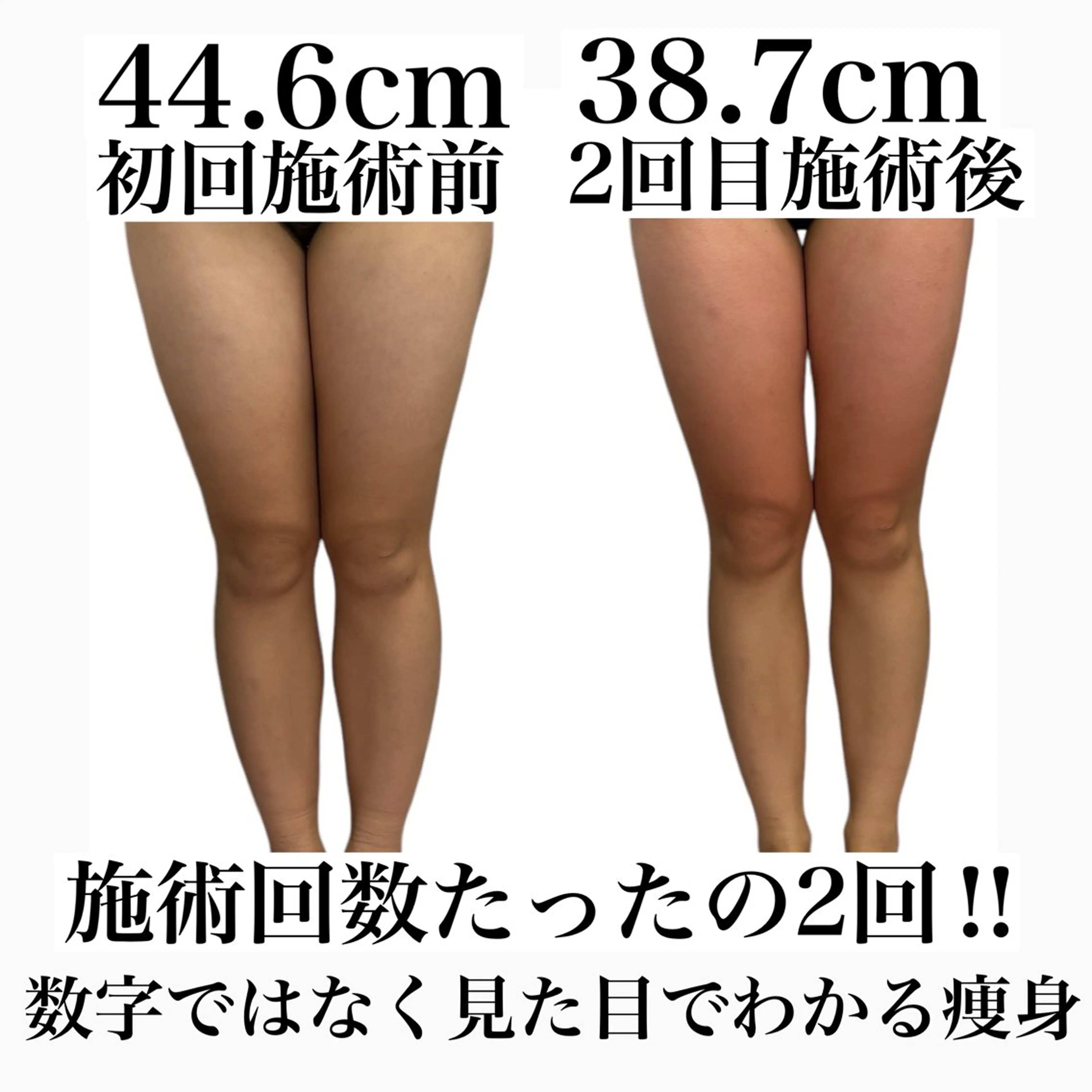 エステ リラク Beauty SalonEclatのエステ・リラクイメージ