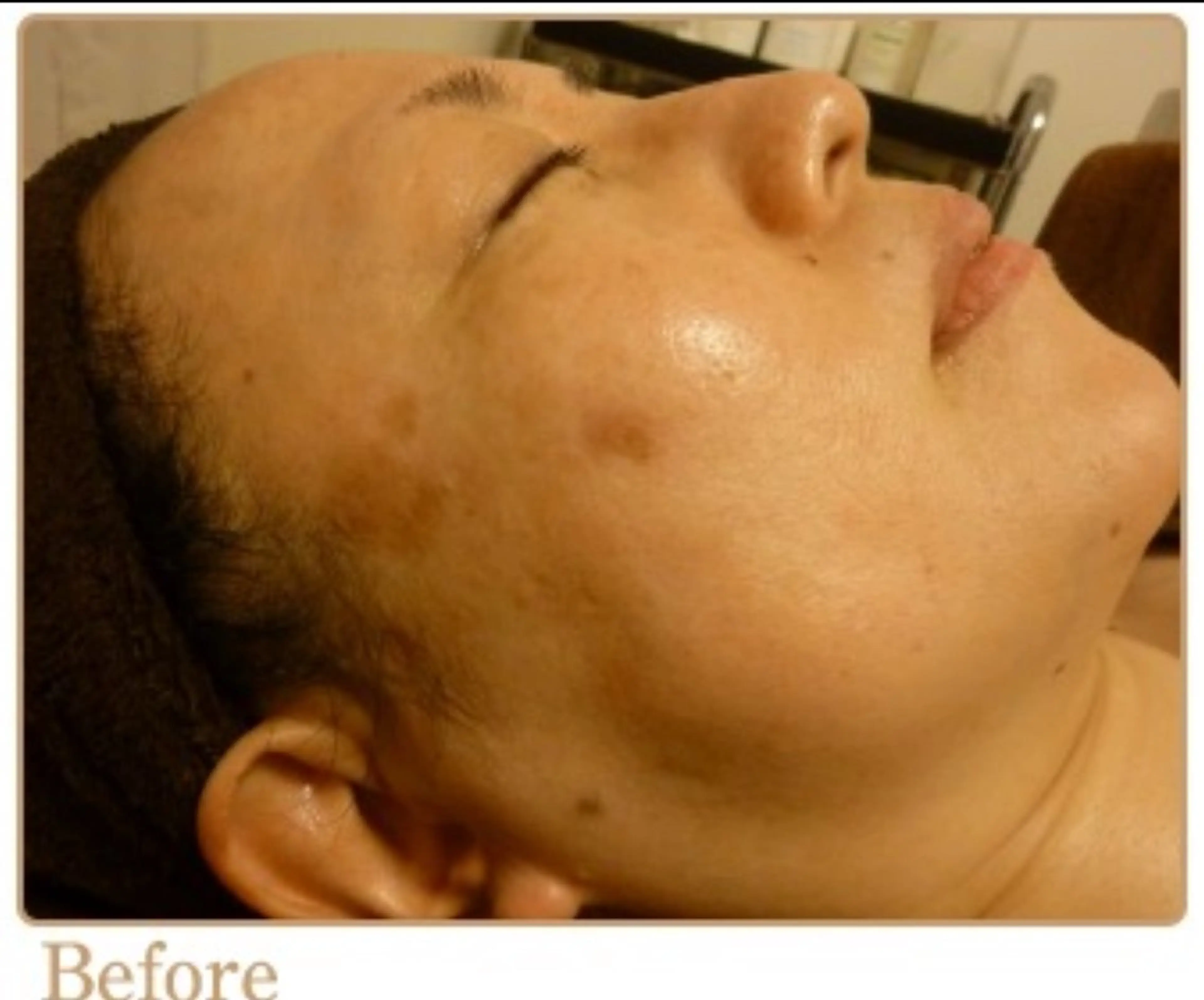 ピーリングサロン シャンテールのエステ・リラクイメージ