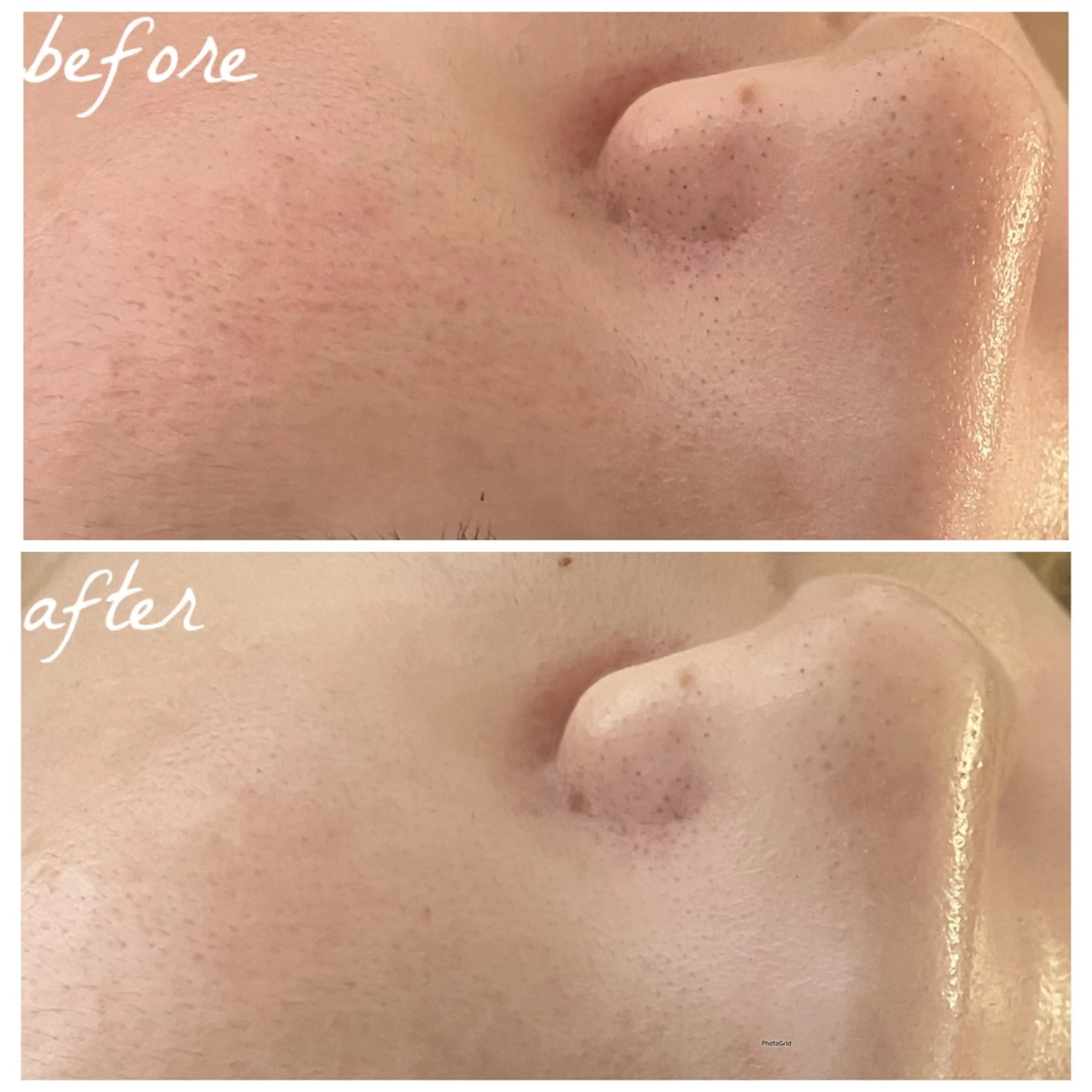 メンズ エステ メナード岐阜茜部 杉浦のエステ・リラクイメージ