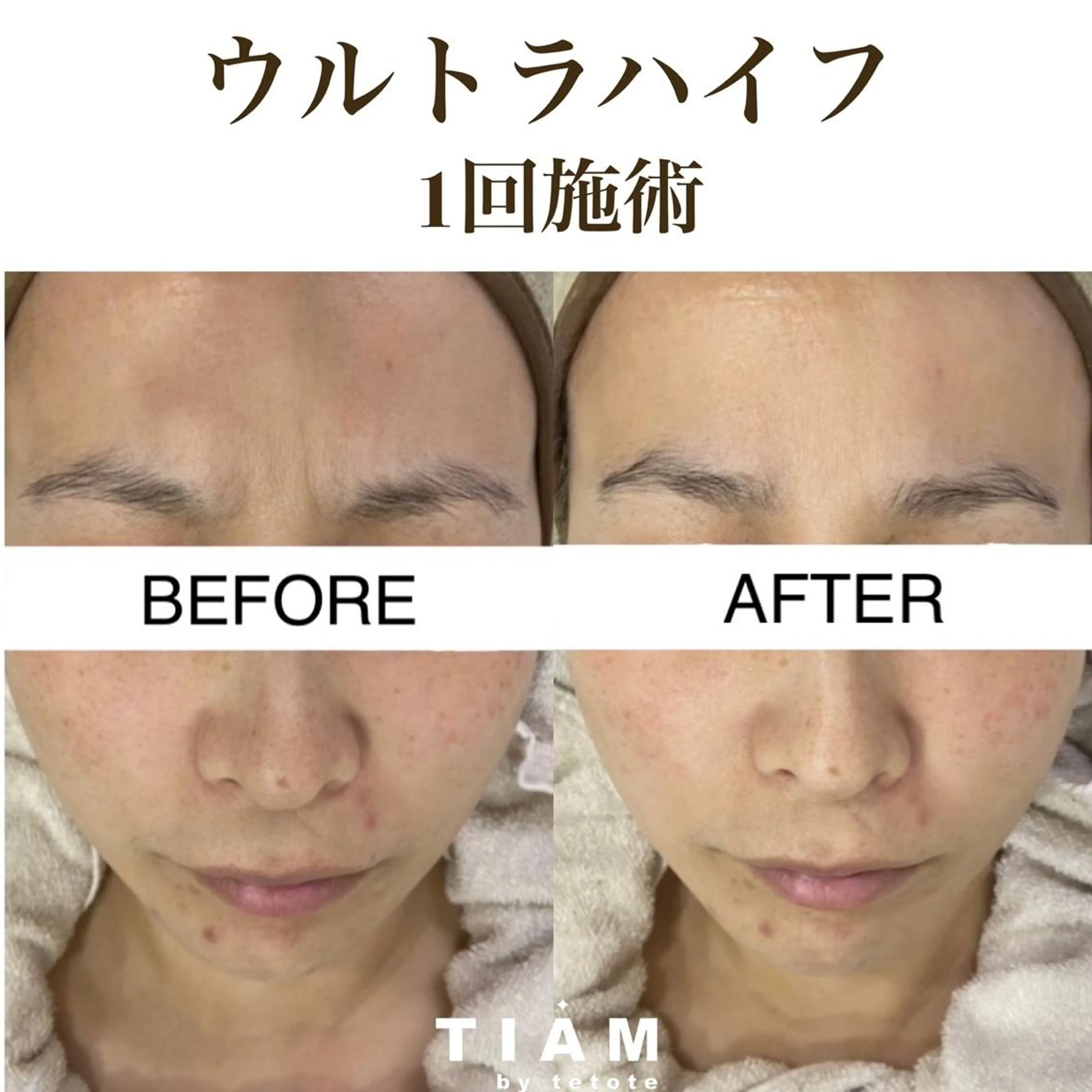 美肌サロンTIAM by tetoteのエステ・リラクイメージ