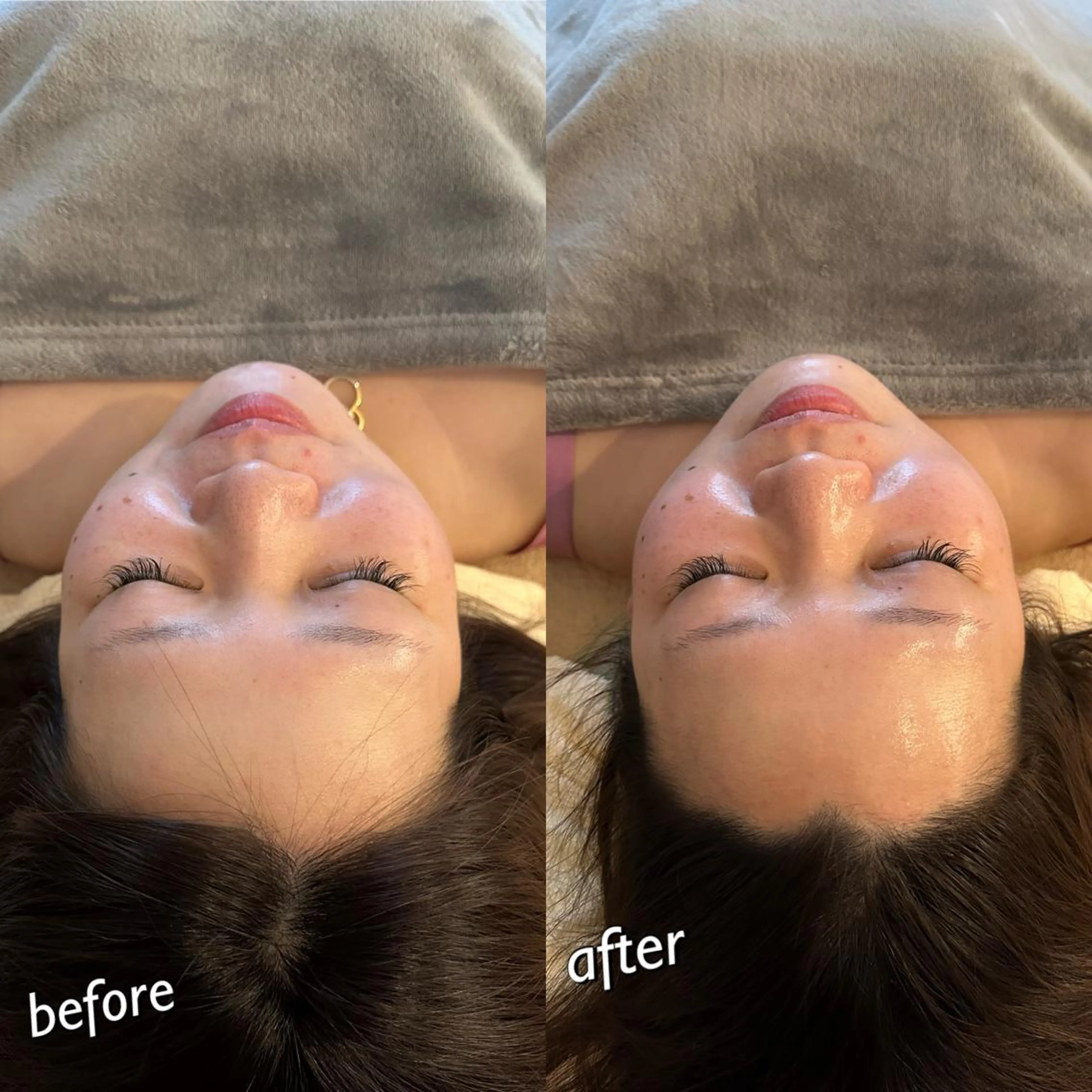 うなじ脱毛/美肌脱毛 LABELのエステ・リラクイメージ