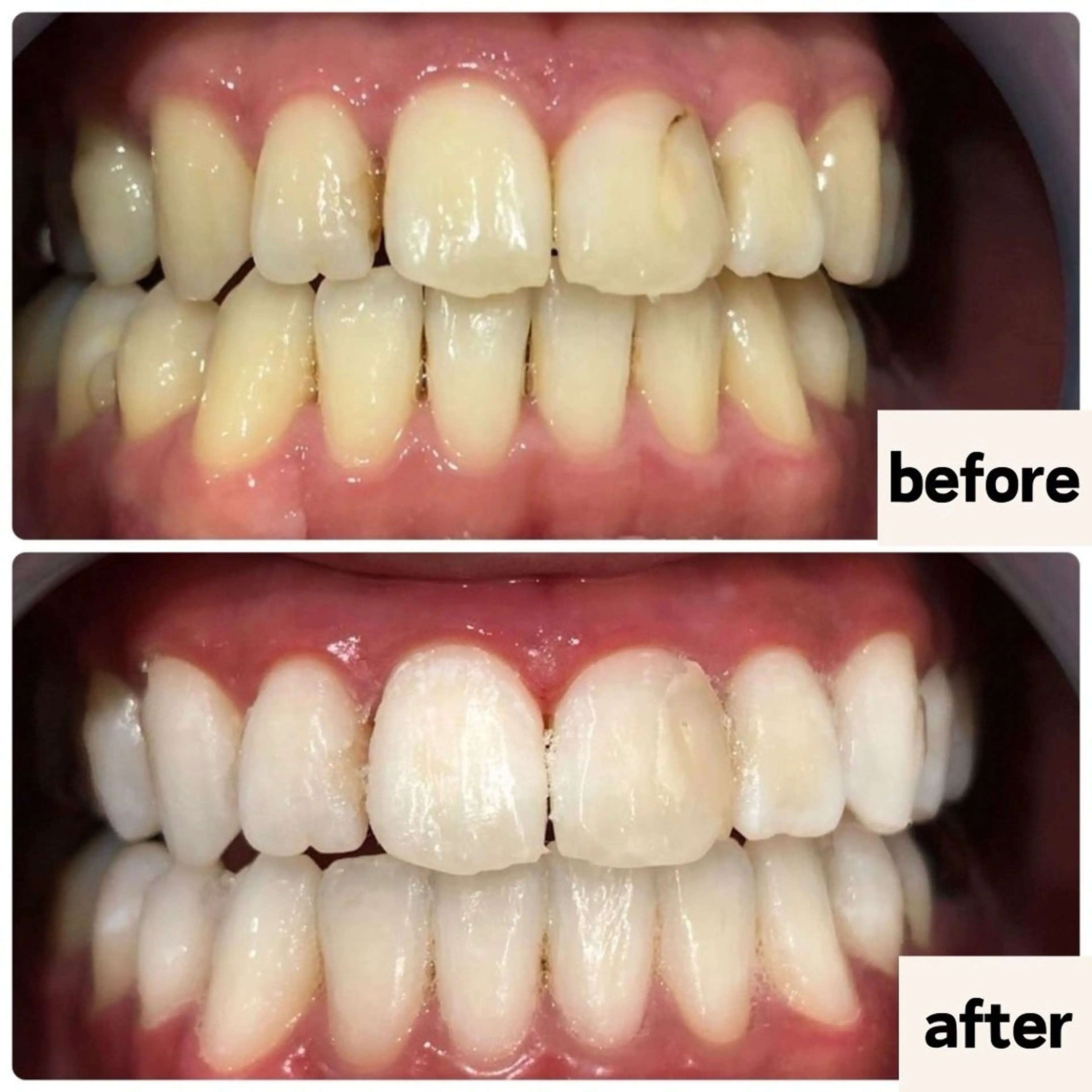 お肌と歯のサロン　Sona Mior所属・藤井 ののみのエステ・リラクイメージ