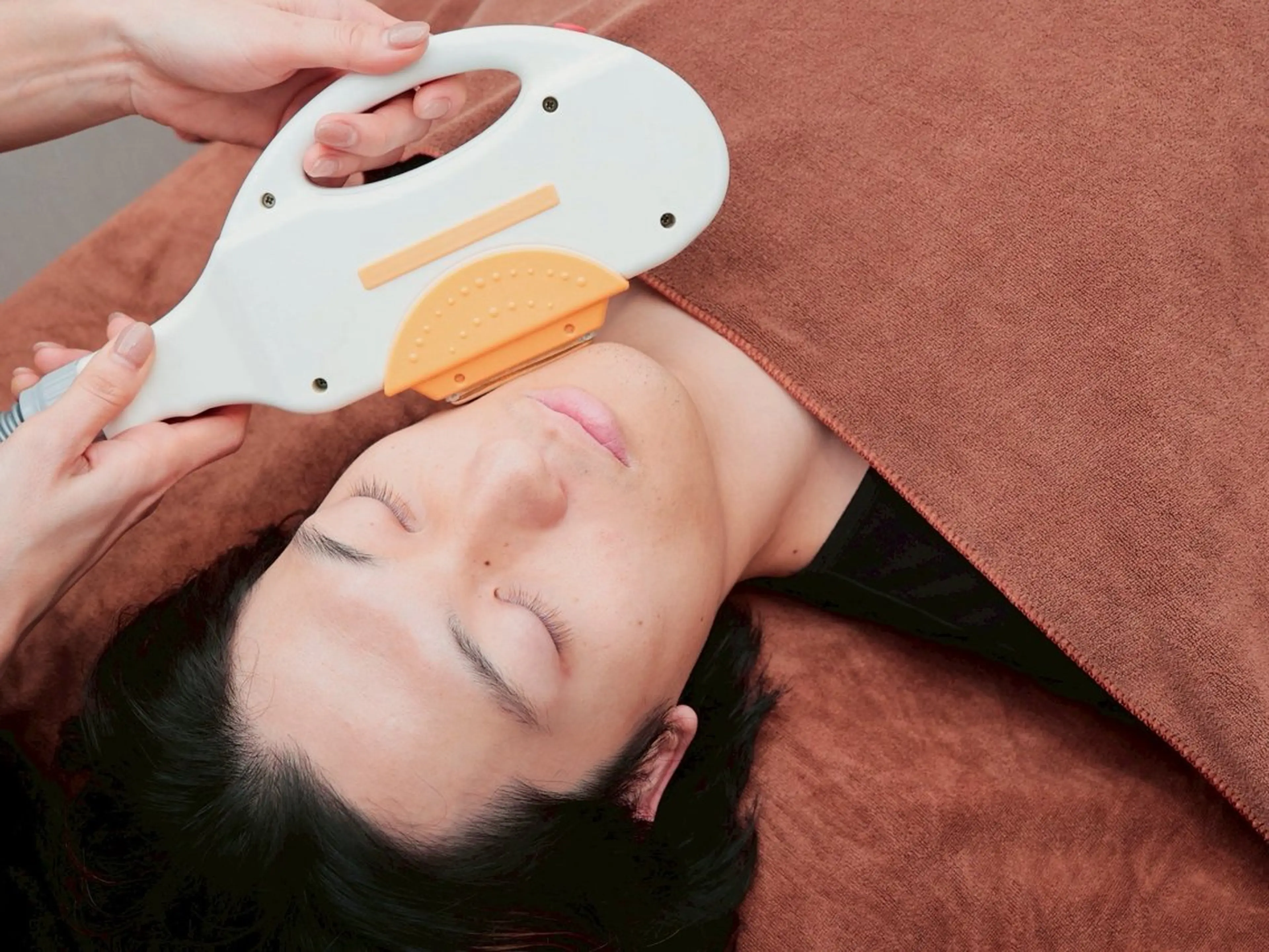 メンズ全身脱毛(顔・VIO込み)の写真