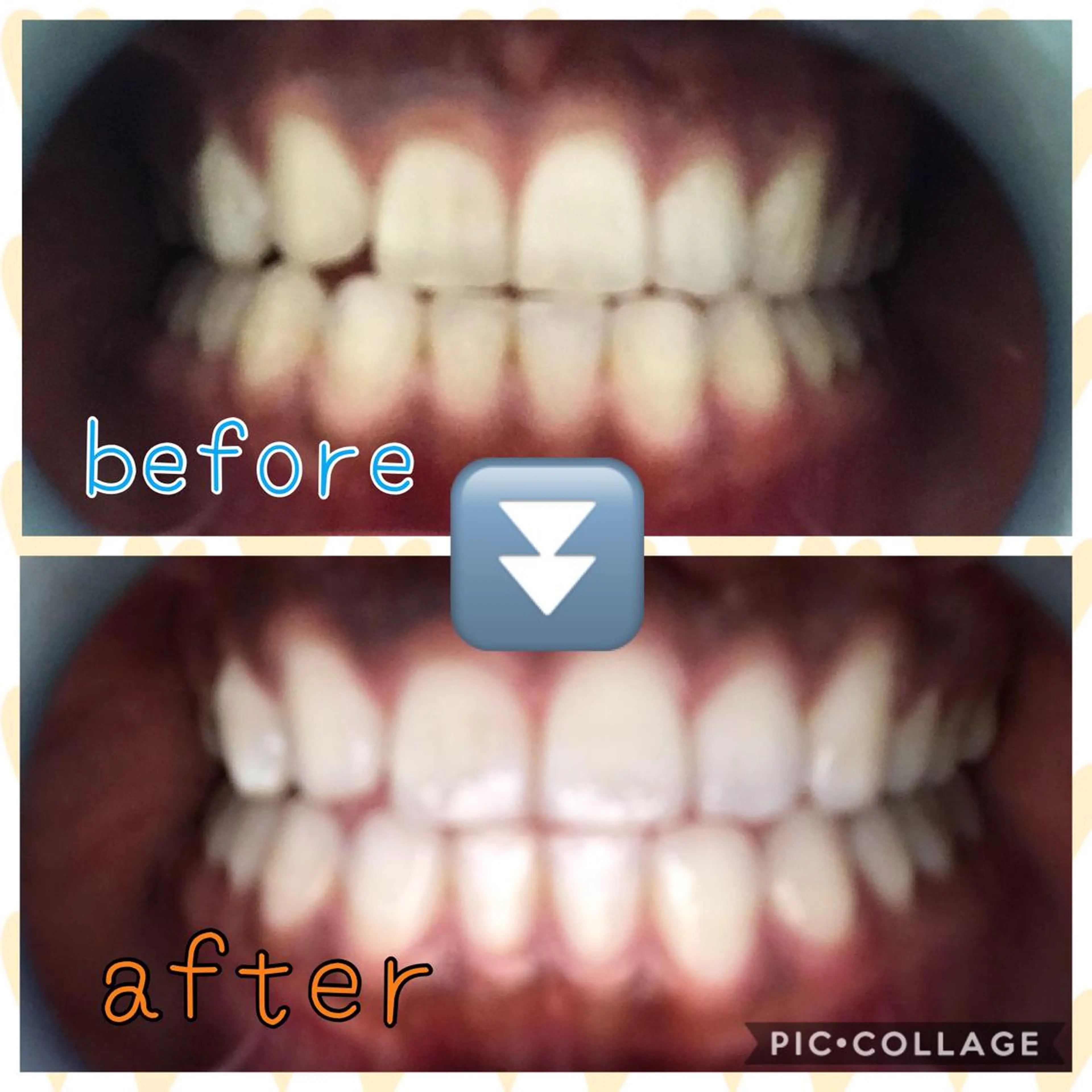 self whitening  BIOLUS所属・whitening BIOLUSのその他イメージ