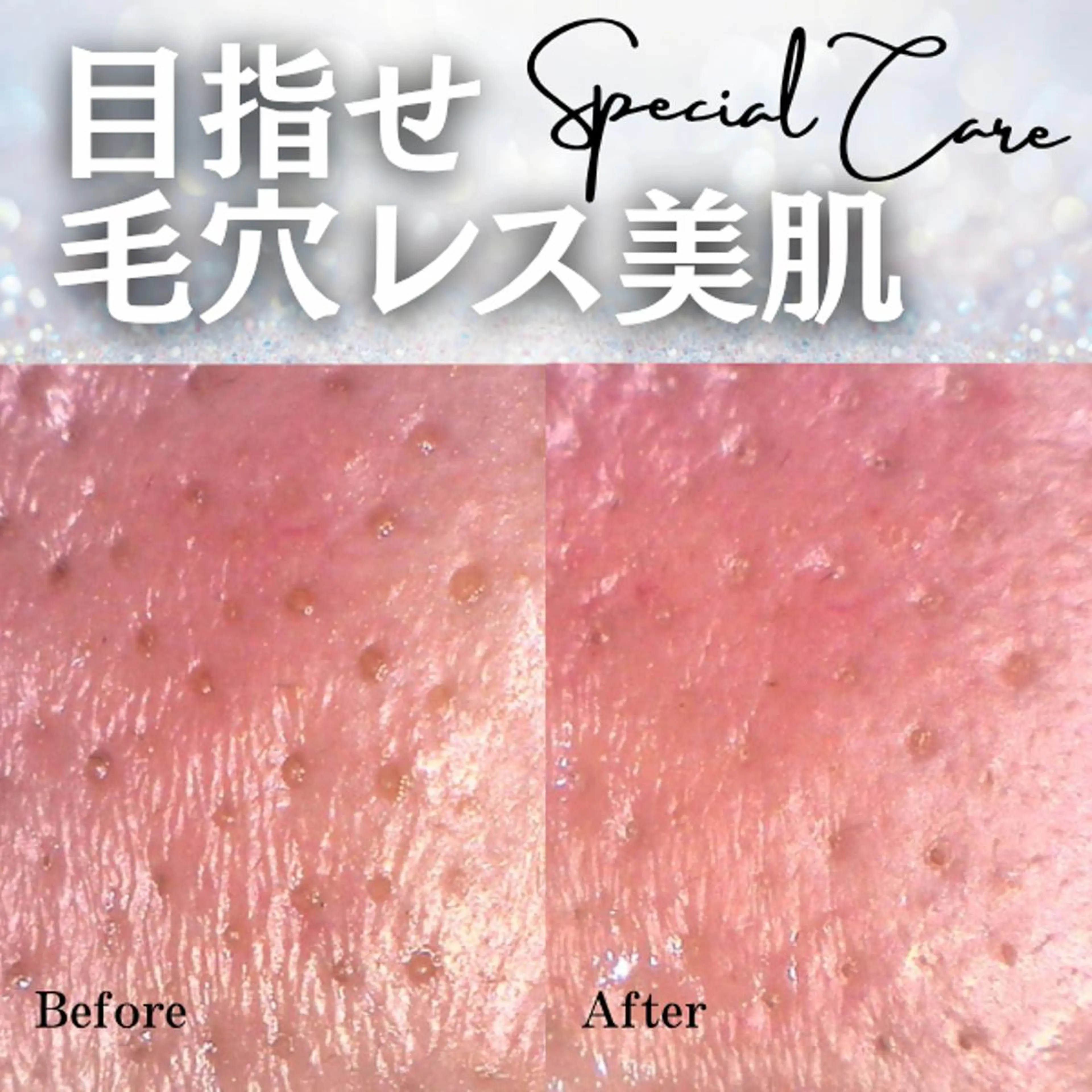 20代メンズのためのお手入れ/徹底皮脂対策！皮脂詰まり、黒ずみ、乾燥の写真