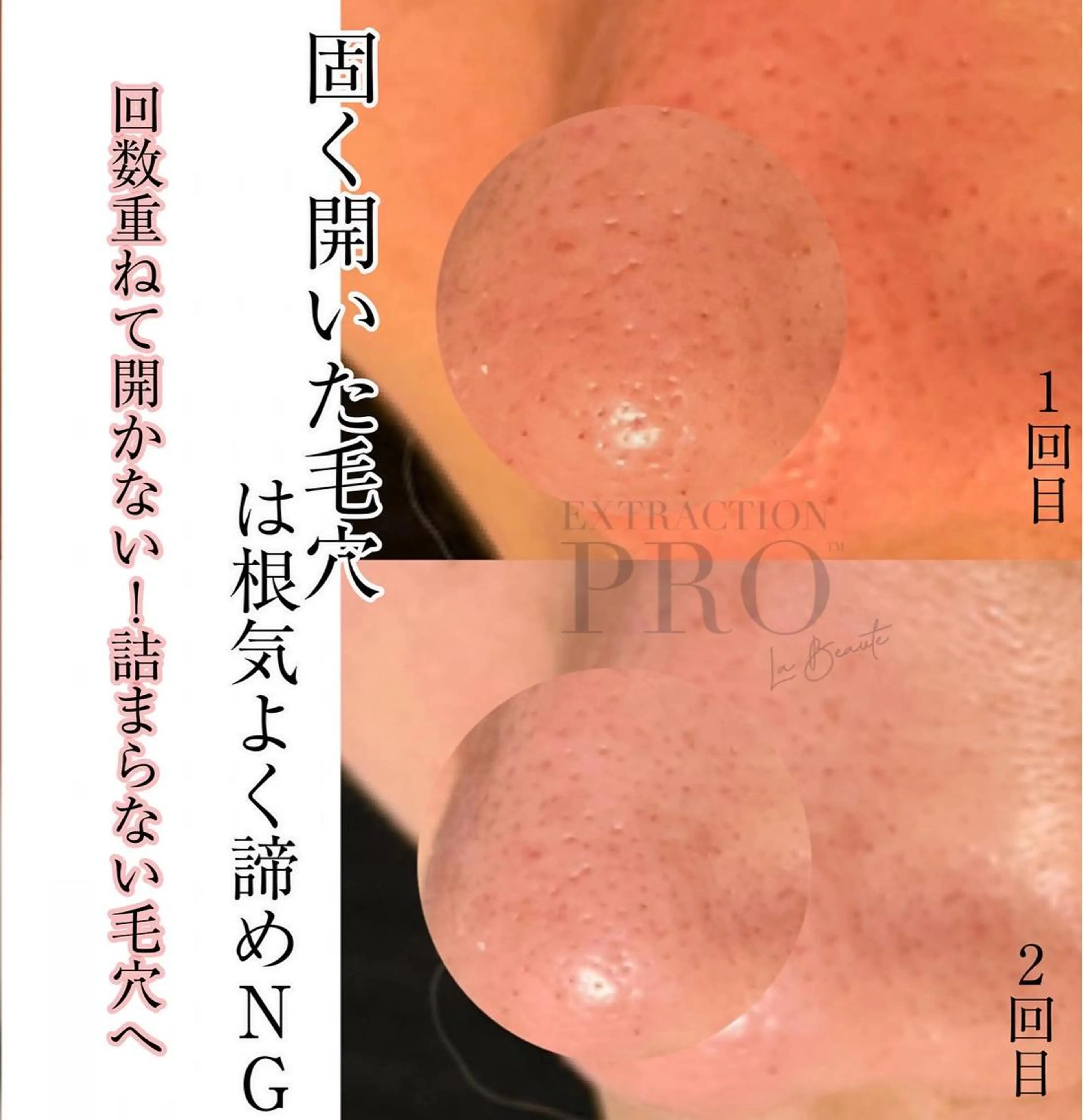 Mignon +所属・Mignon + Natsukiのマツエク・マツパデザイン