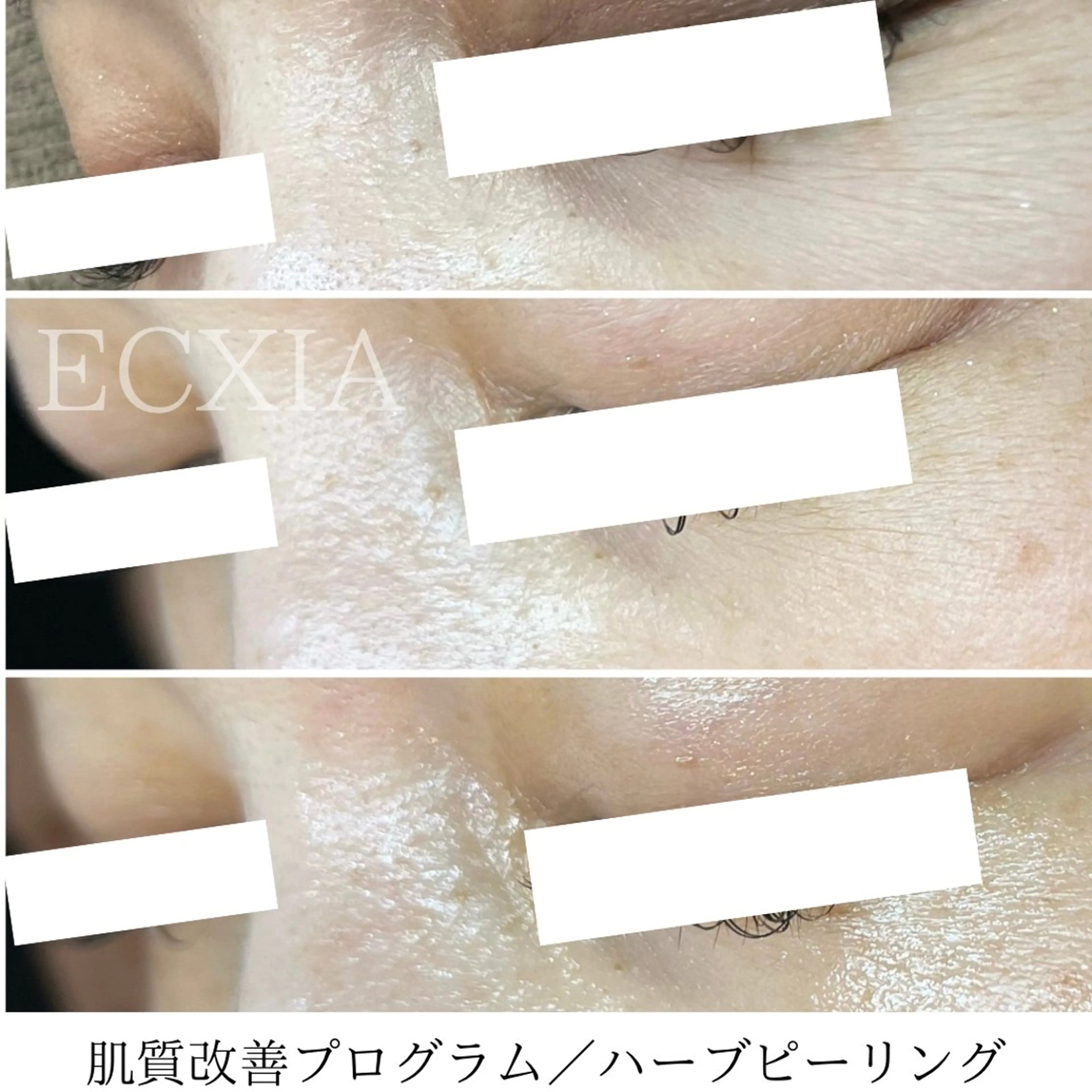 エステ ECXIA 【エクシア】のエステ・リラクイメージ