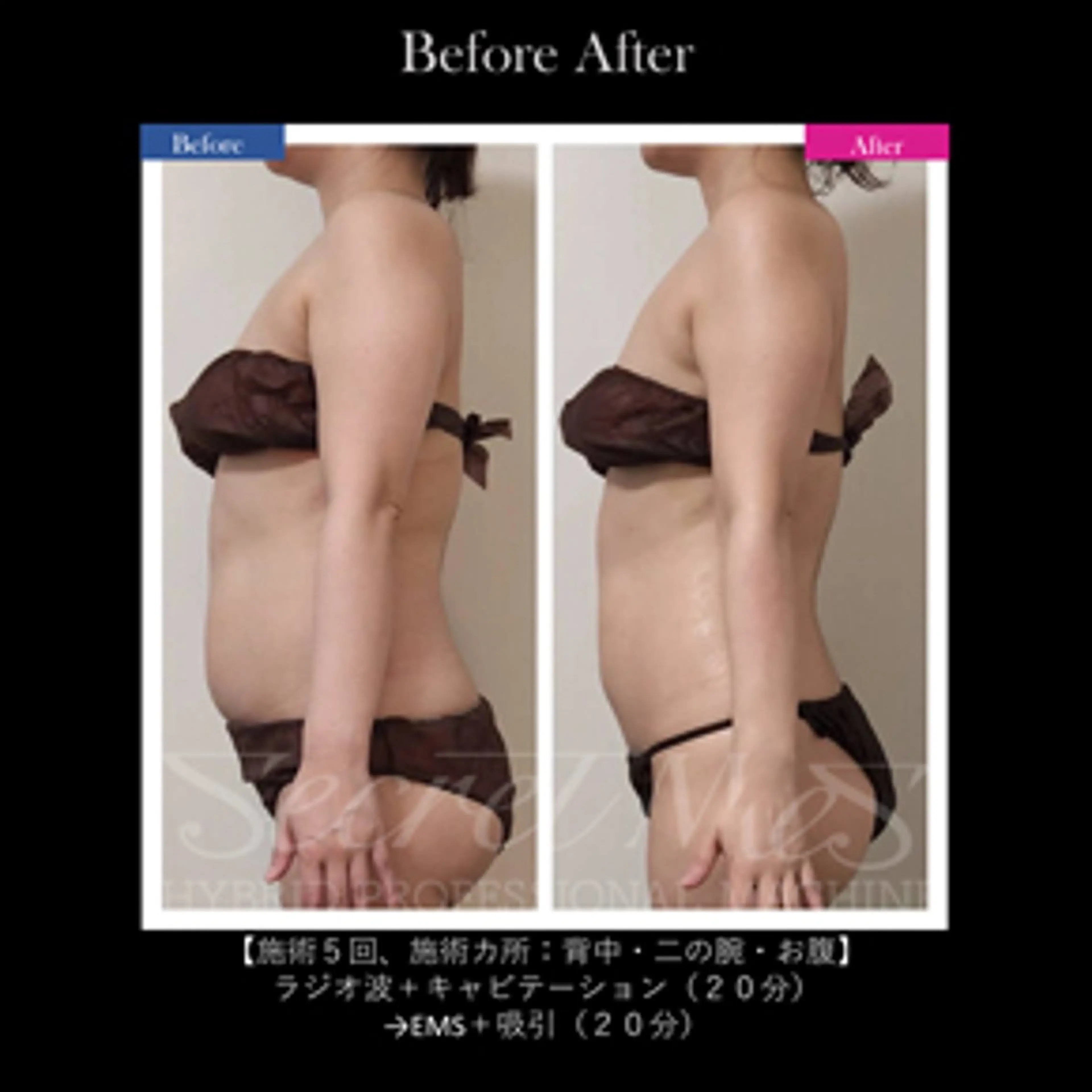 伊藤 正美のマツエク・マツパデザイン