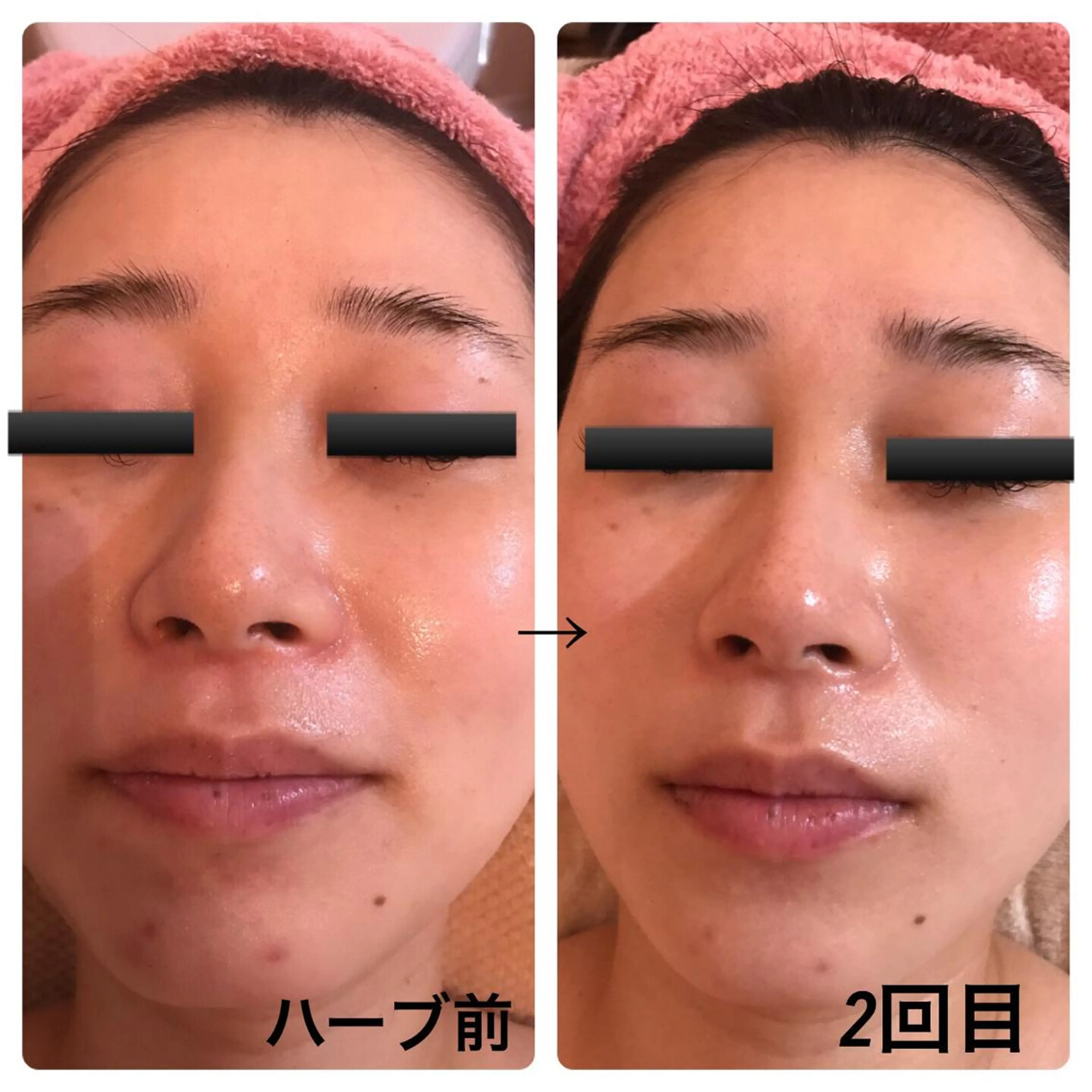 フェアリーローズ所属・fairyrose organicエステのエステ・リラクイメージ