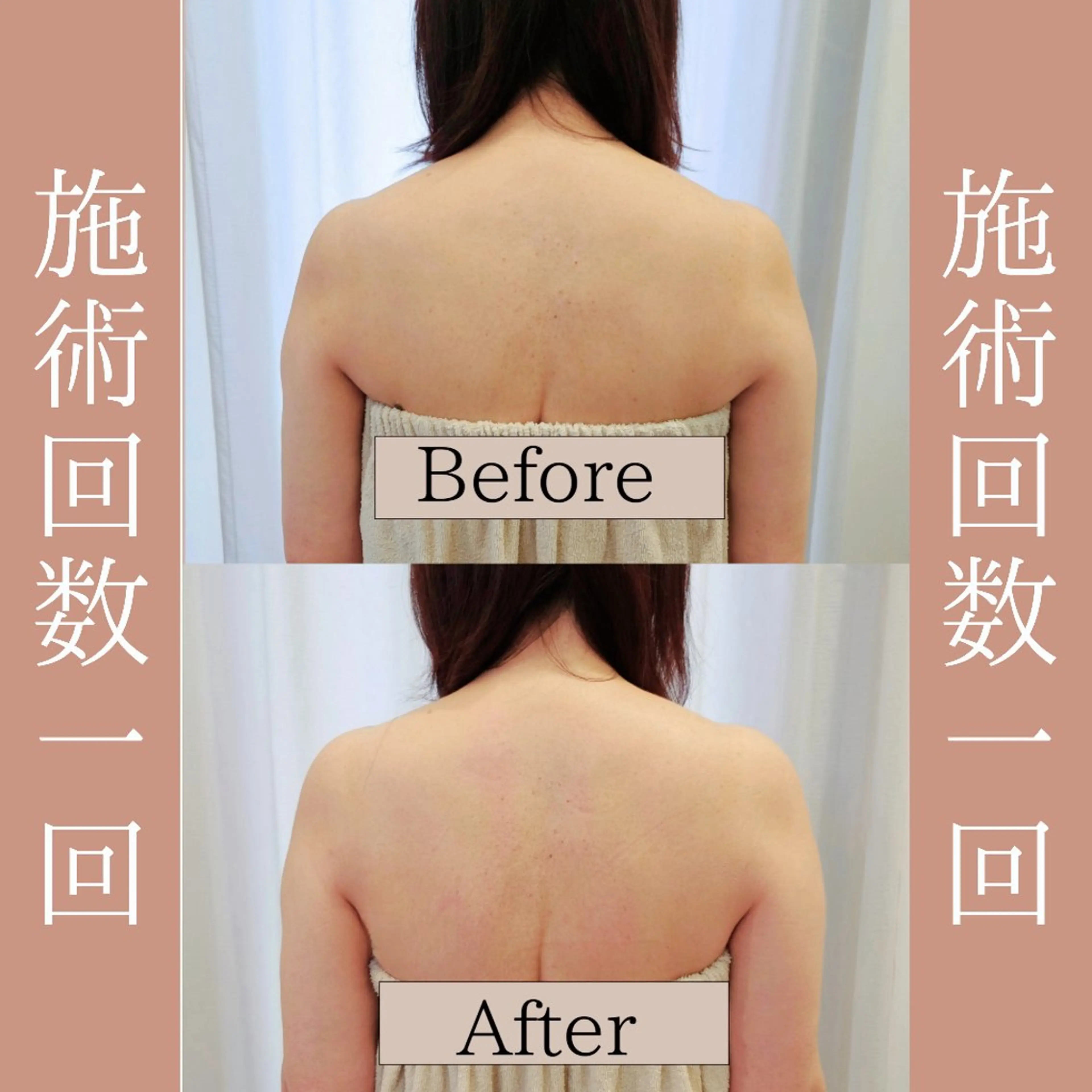 眠れないほどの辛い肩こりから解放【ガチガチ肩こり・猫背・巻き肩】全身強圧リンパ+美容整体 (100分)の写真