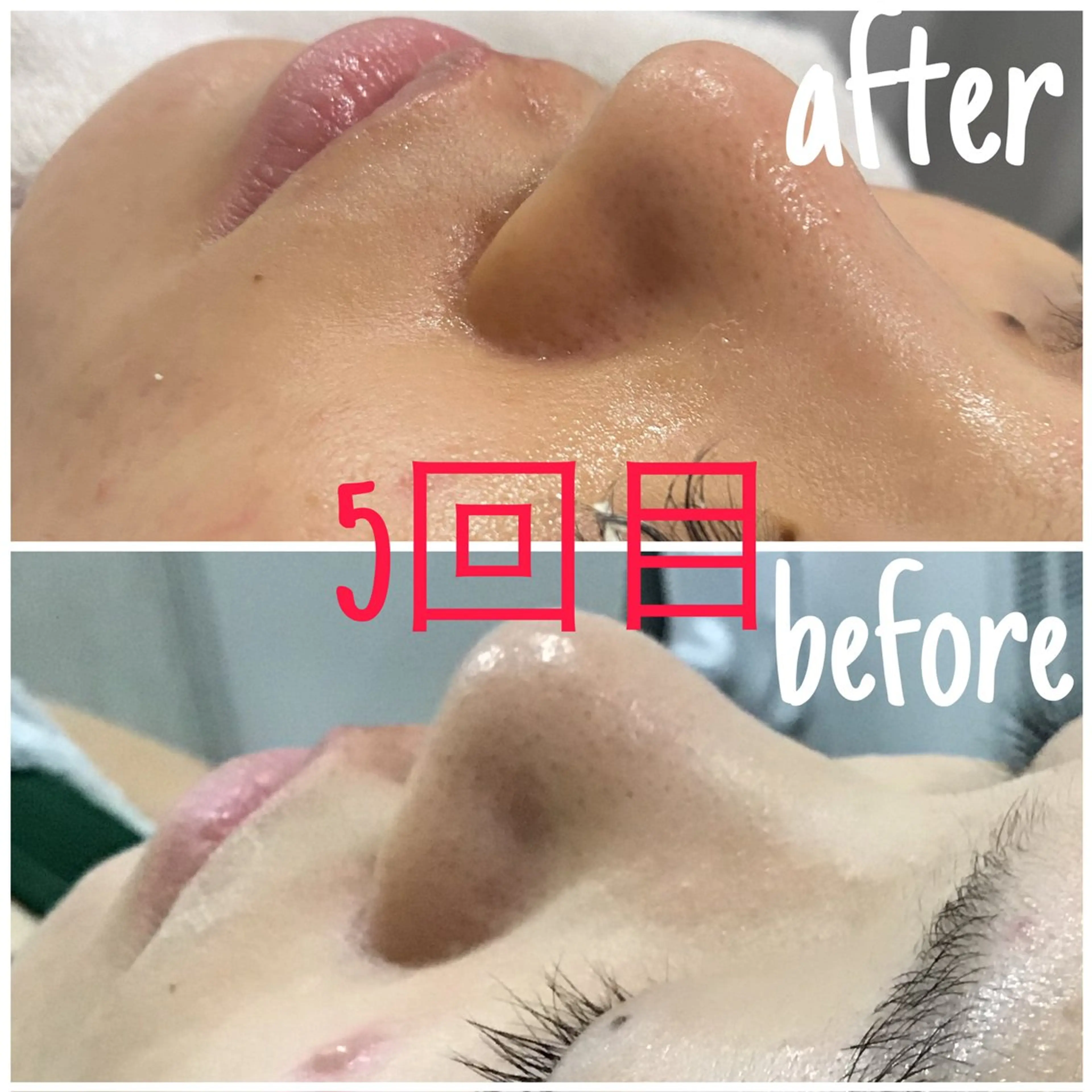 アルカンジュ~archange~所属・痩身/毛穴洗浄/脱毛 アルカンジュのエステ・リラクイメージ