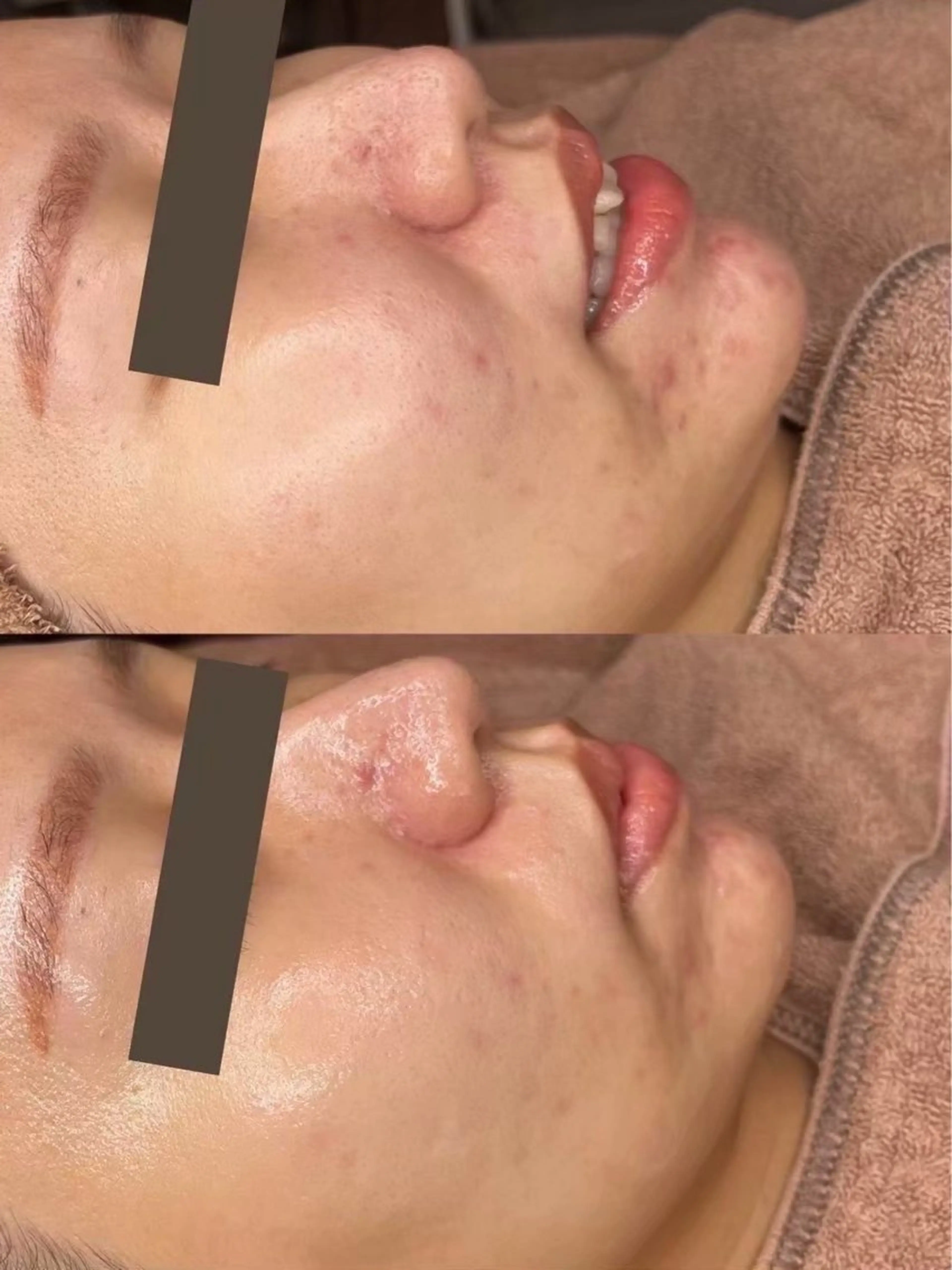 エステ 韓国肌管理専門店　White labo 梅田店所属・大西 亜季のエステ・リラクイメージ