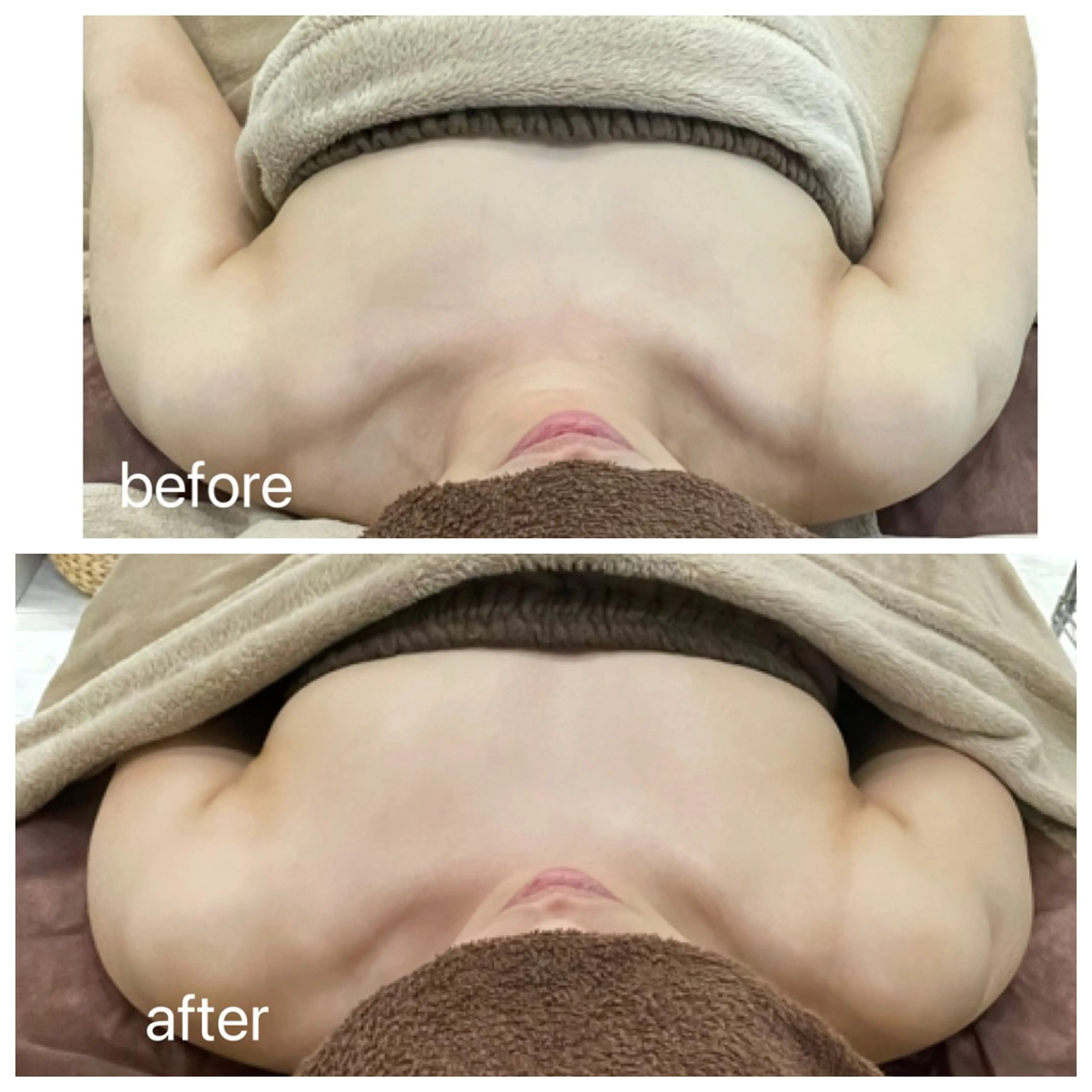 Rene 慢性疲労ケアサロンのエステ・リラクイメージ