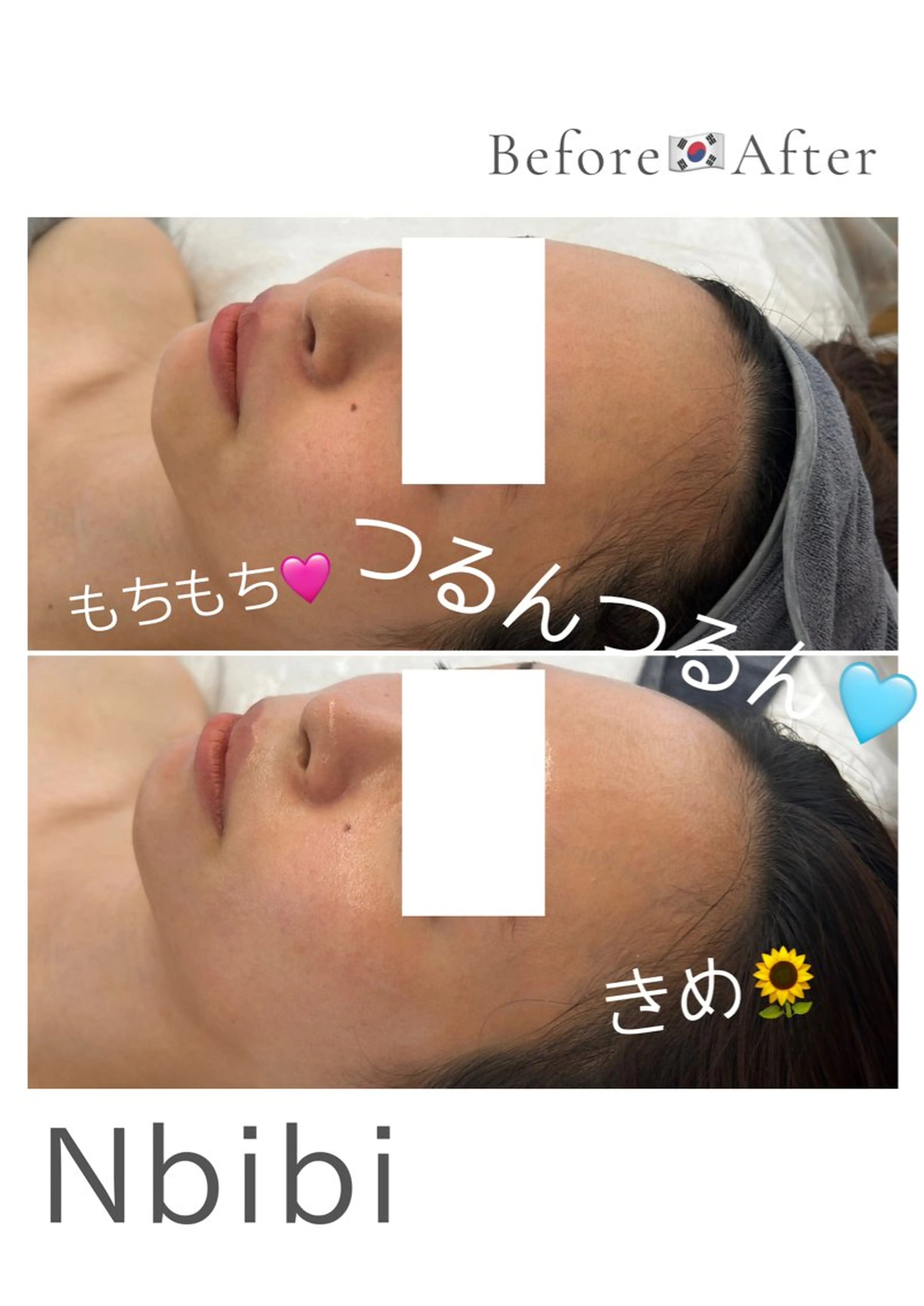 エステ 韓国🇰🇷価格 サロン_Nbibiのエステ・リラクイメージ