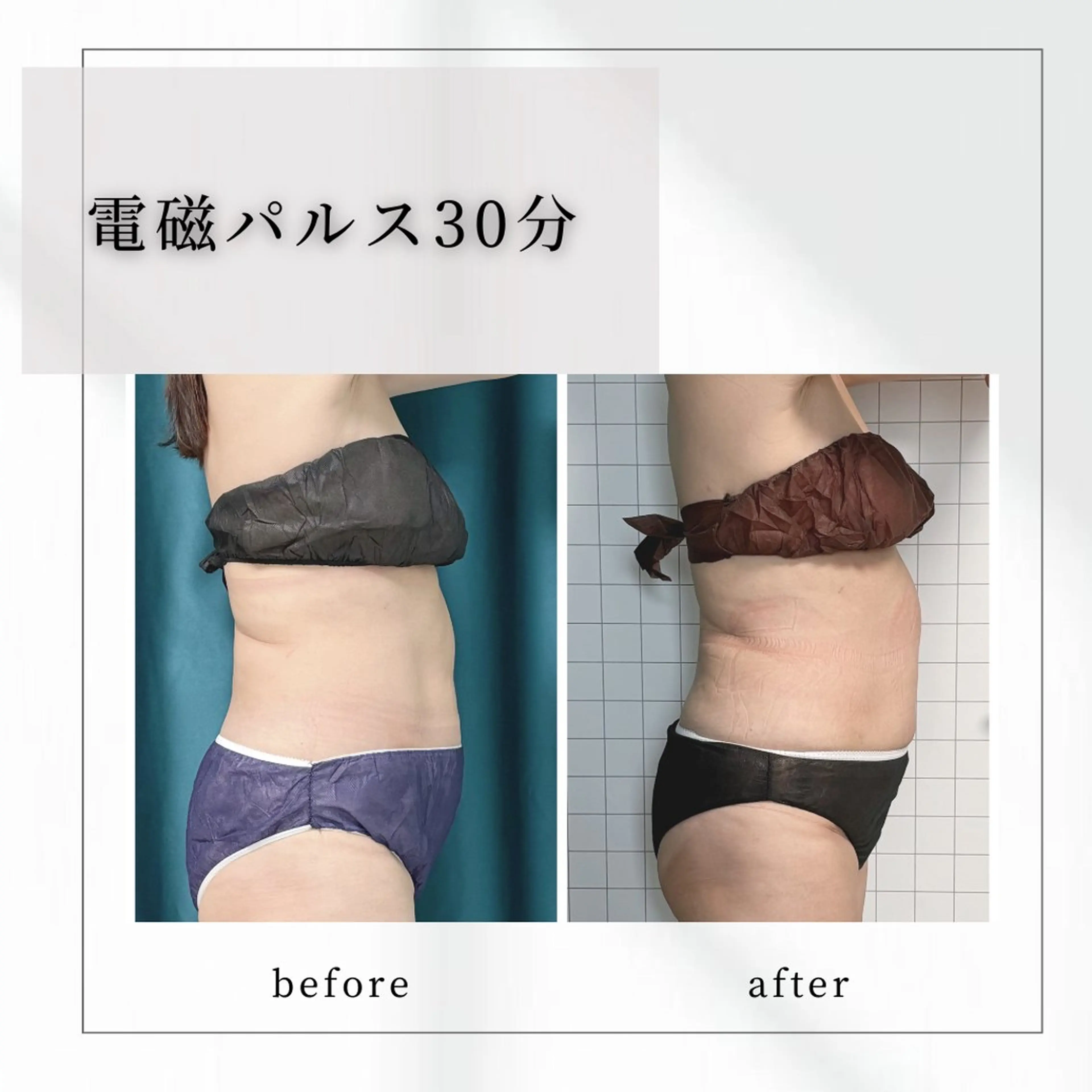 小顔矯正専門店 【RED】池田のエステ・リラクイメージ