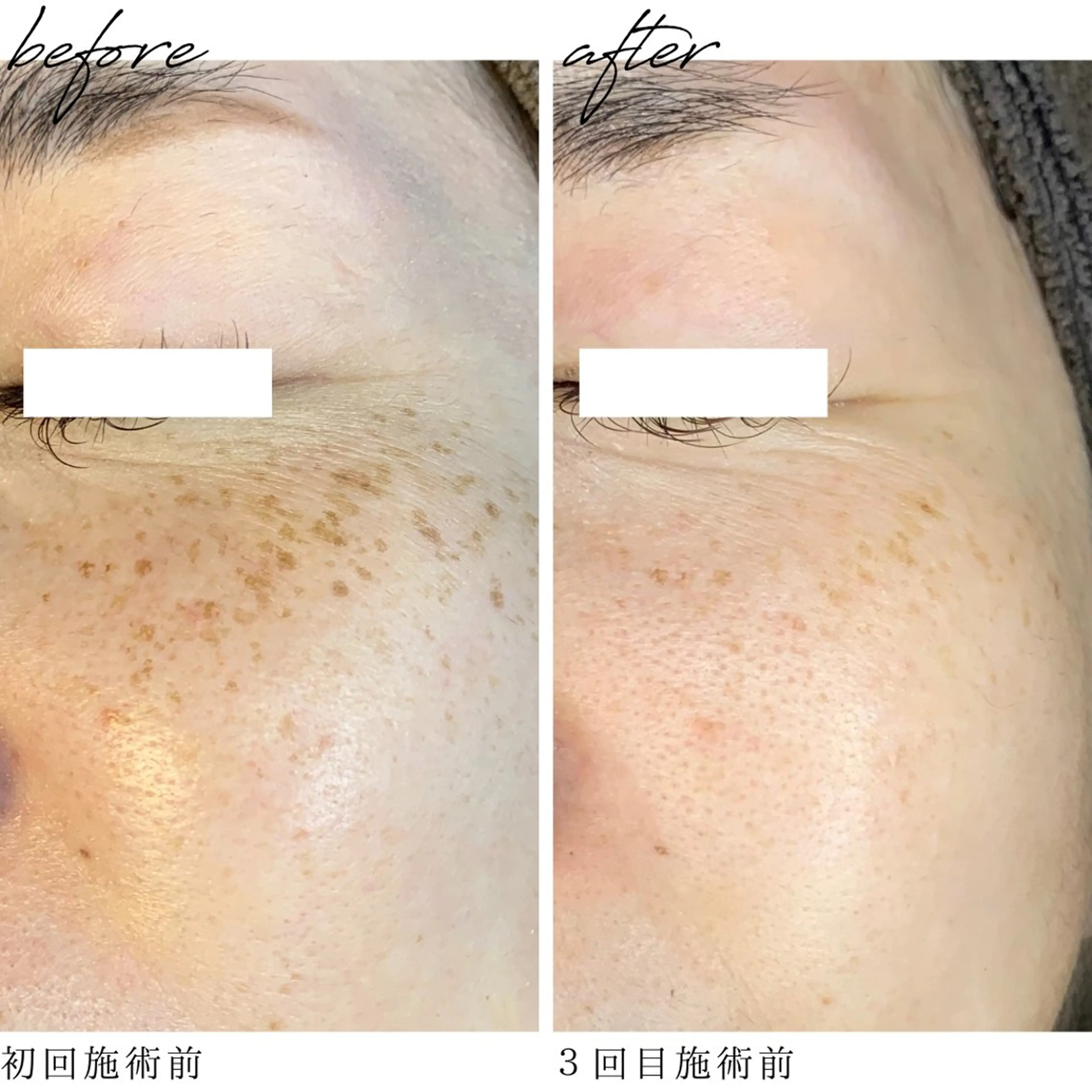 最新シミケアLily de pearlのエステ・リラクイメージ