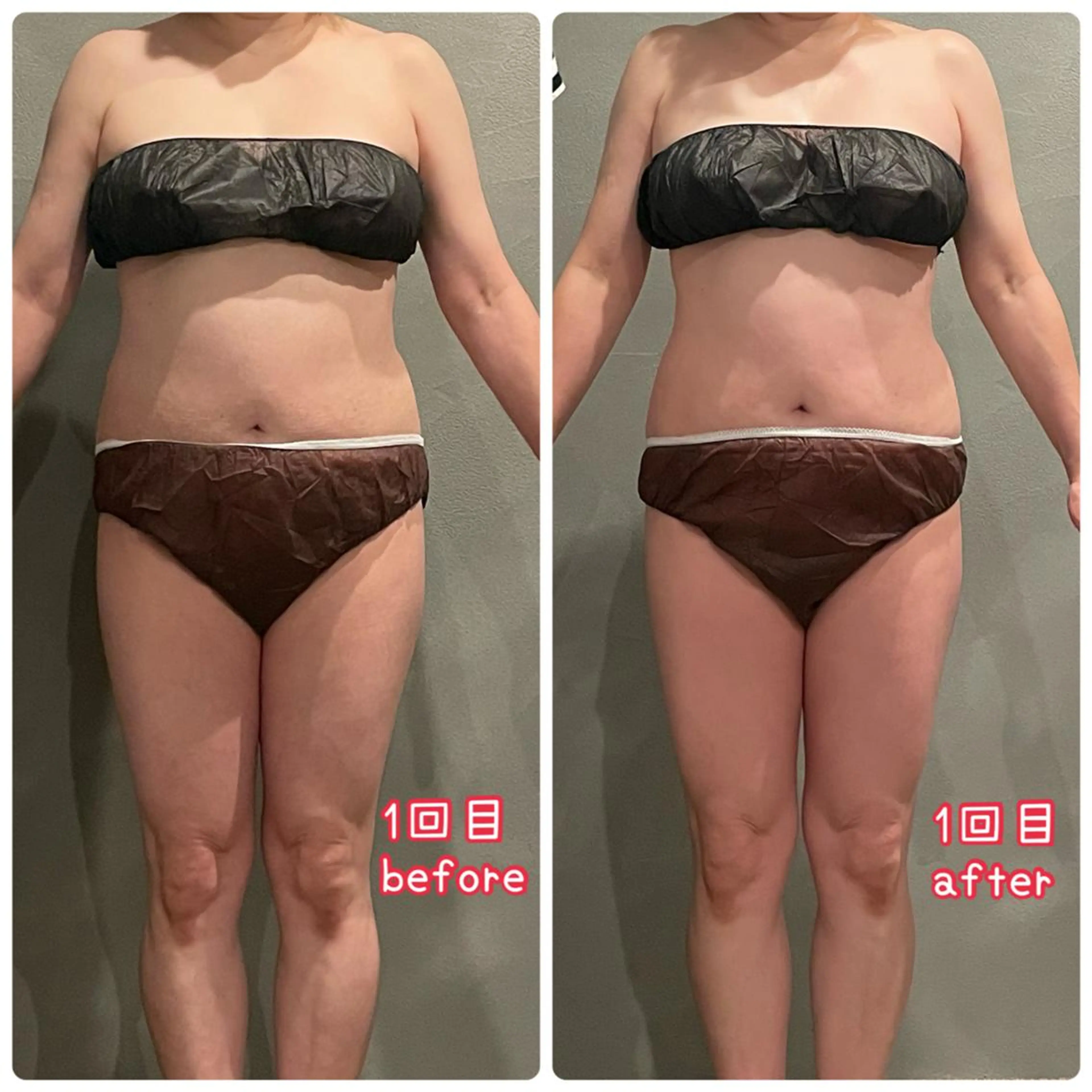 カラダデザインサロン 2upのエステ・リラクイメージ