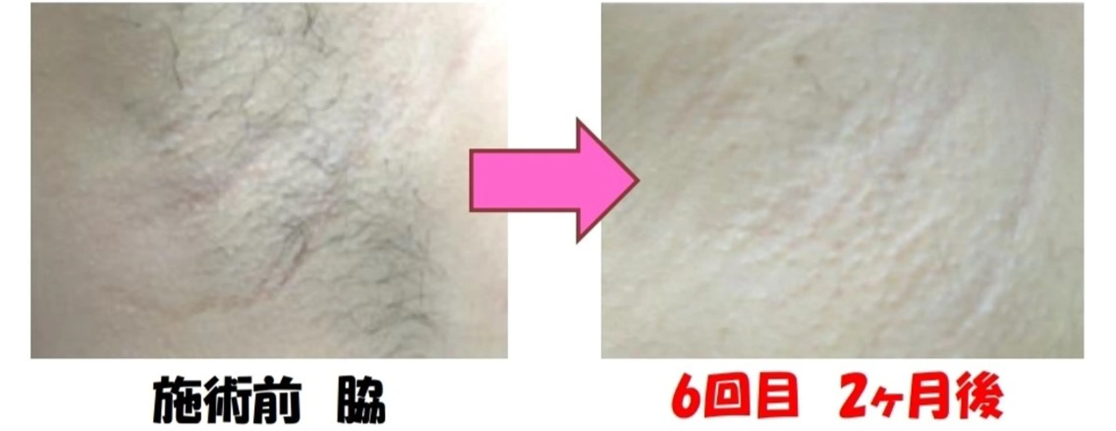 Salon Ree Belle(サロン リベル)所属・サロン リベル YUKAのエステ・リラクイメージ