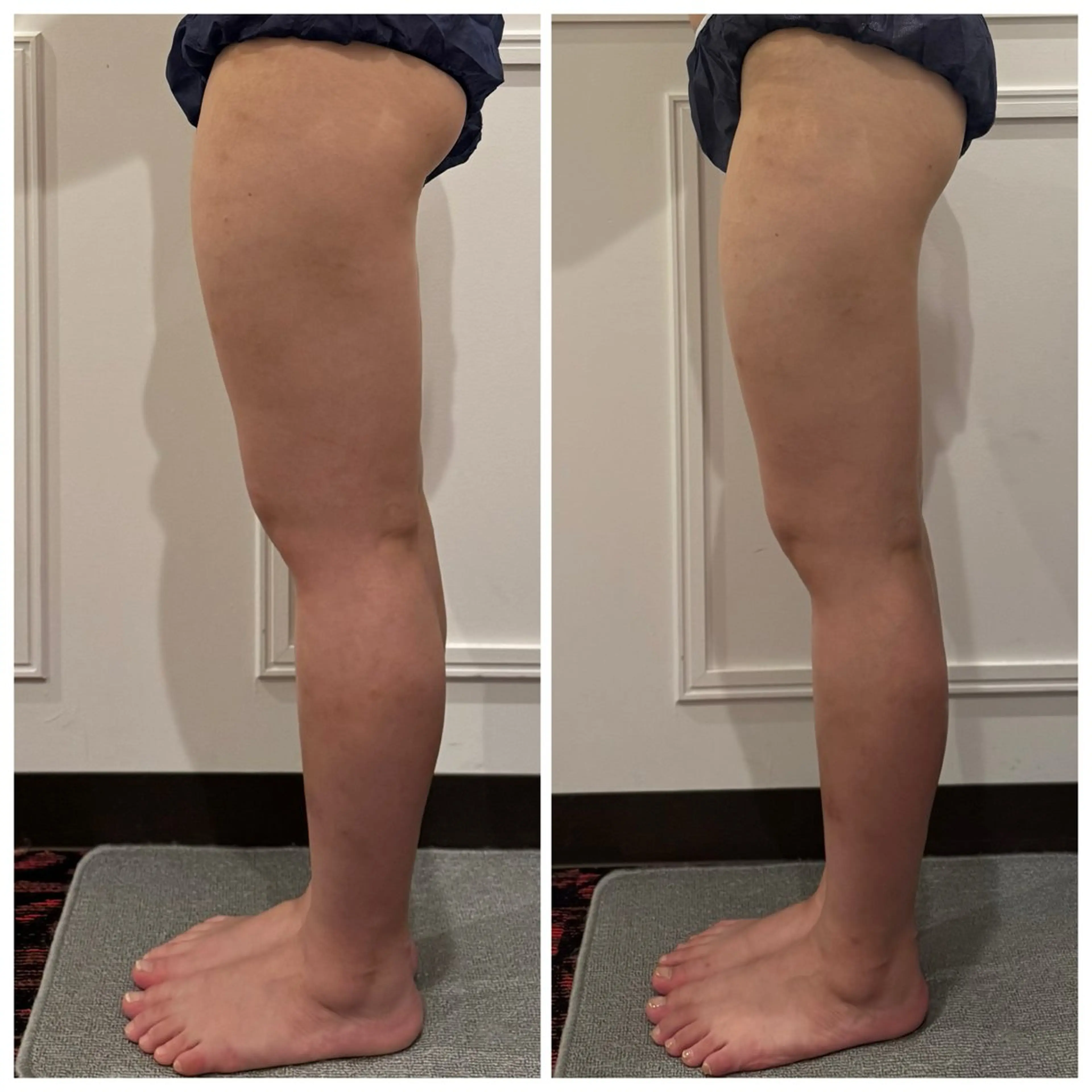 通うほど変わる本格 エステ心斎橋REVIのエステ・リラクイメージ