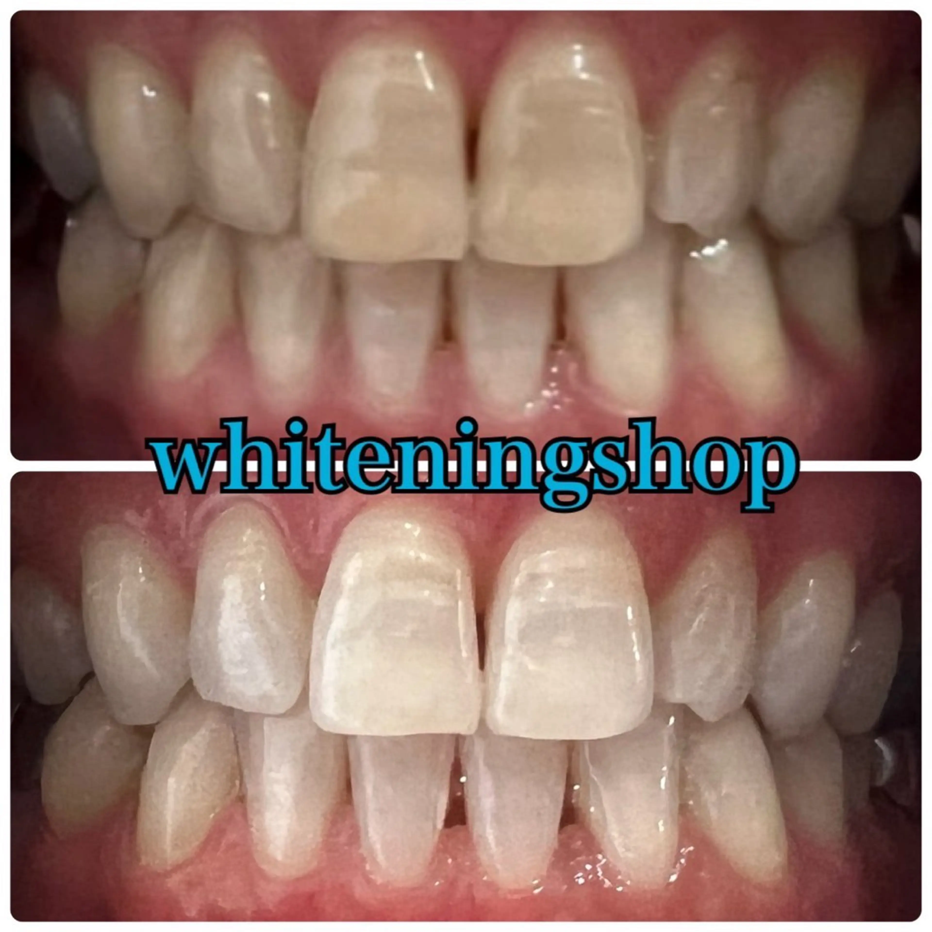 ホワイトニングショップ津店所属・ホワイトニング ショップ津店のその他イメージ