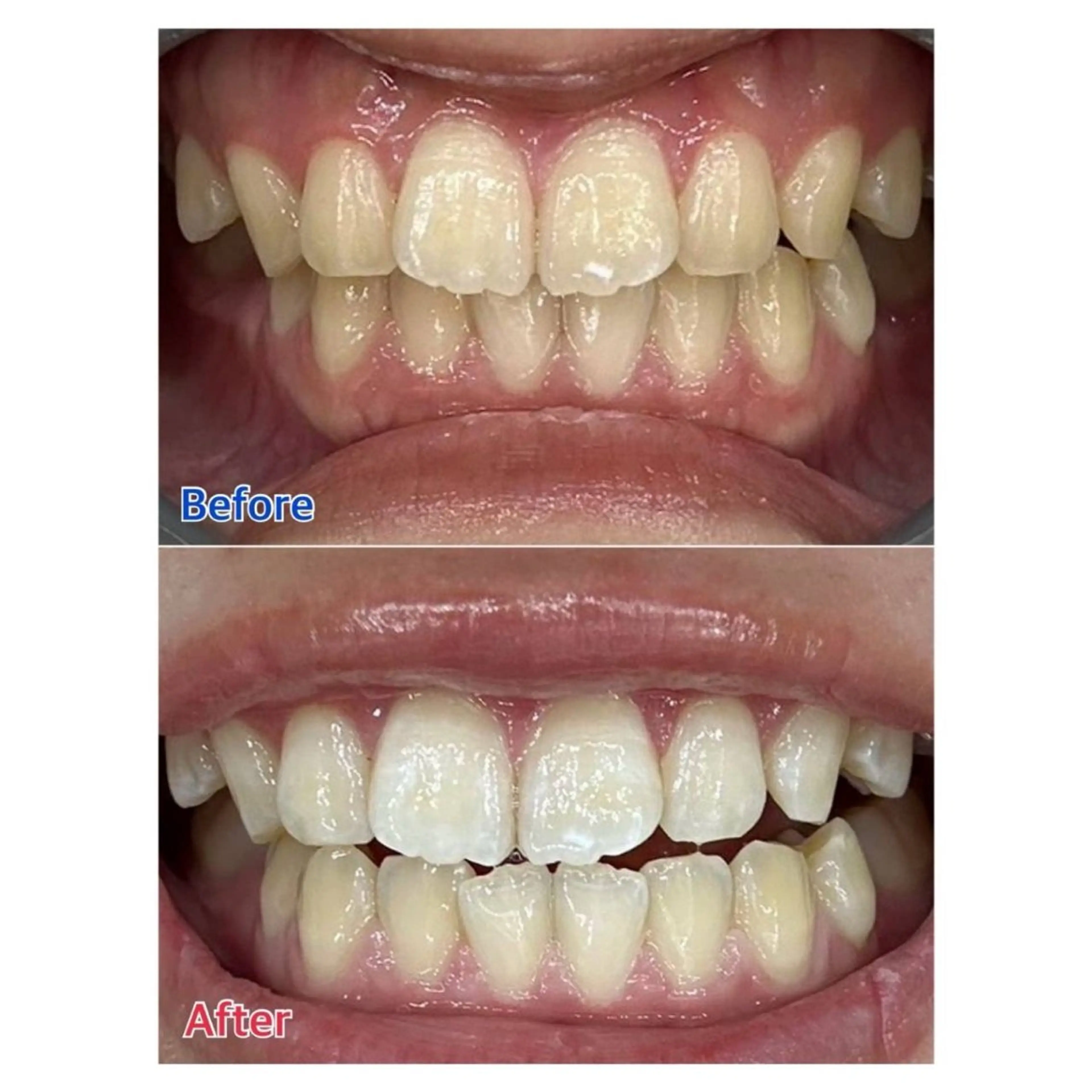 MBEAUTYSALON 千葉店・京成大久保所属・Melty 輝のその他イメージ