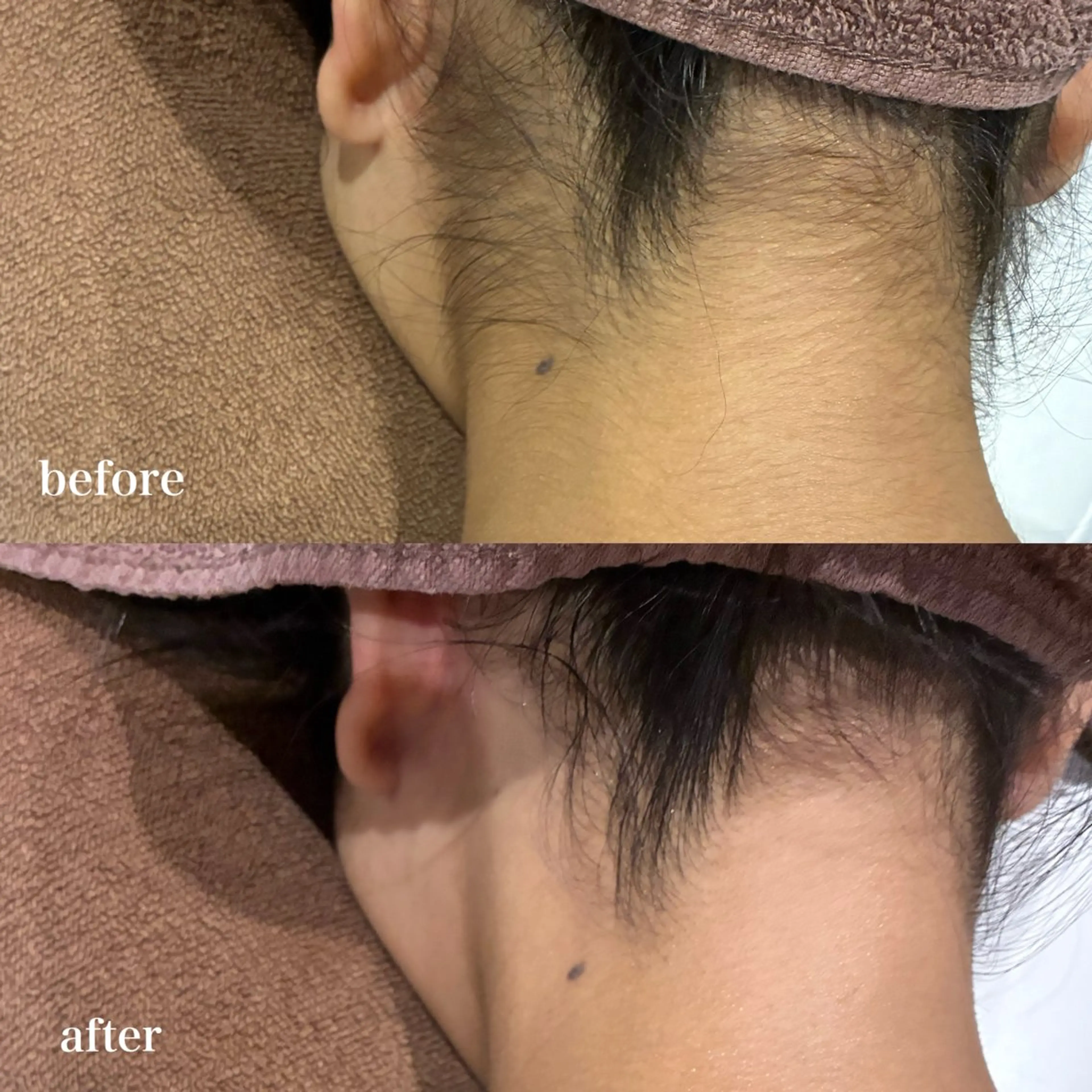 DahliaBeauty ダリアビューティー所属・DahliaBeau tyフェイシャル中村のエステ・リラクイメージ