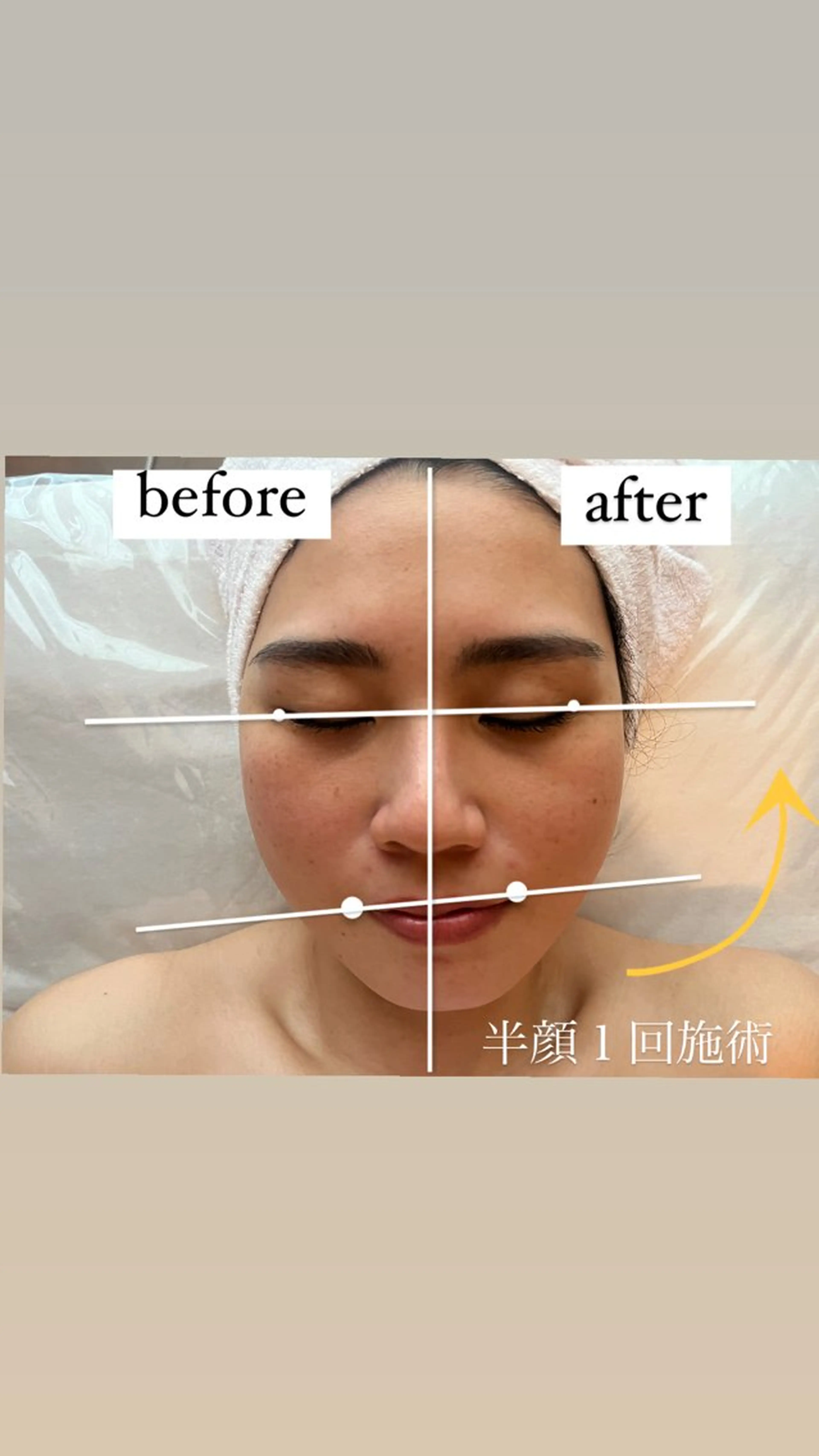 エステ private salon Rii'f.所属・private sa lon Rii'f.のエステ・リラクイメージ