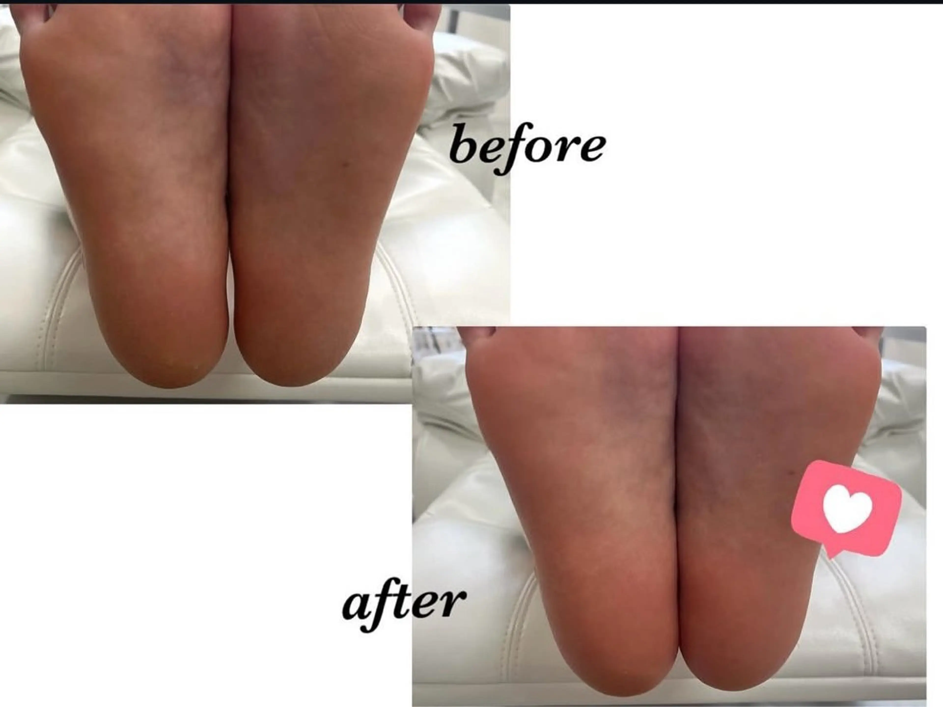 ネイル その他(ネイル) Regene ARAKIのネイルデザイン