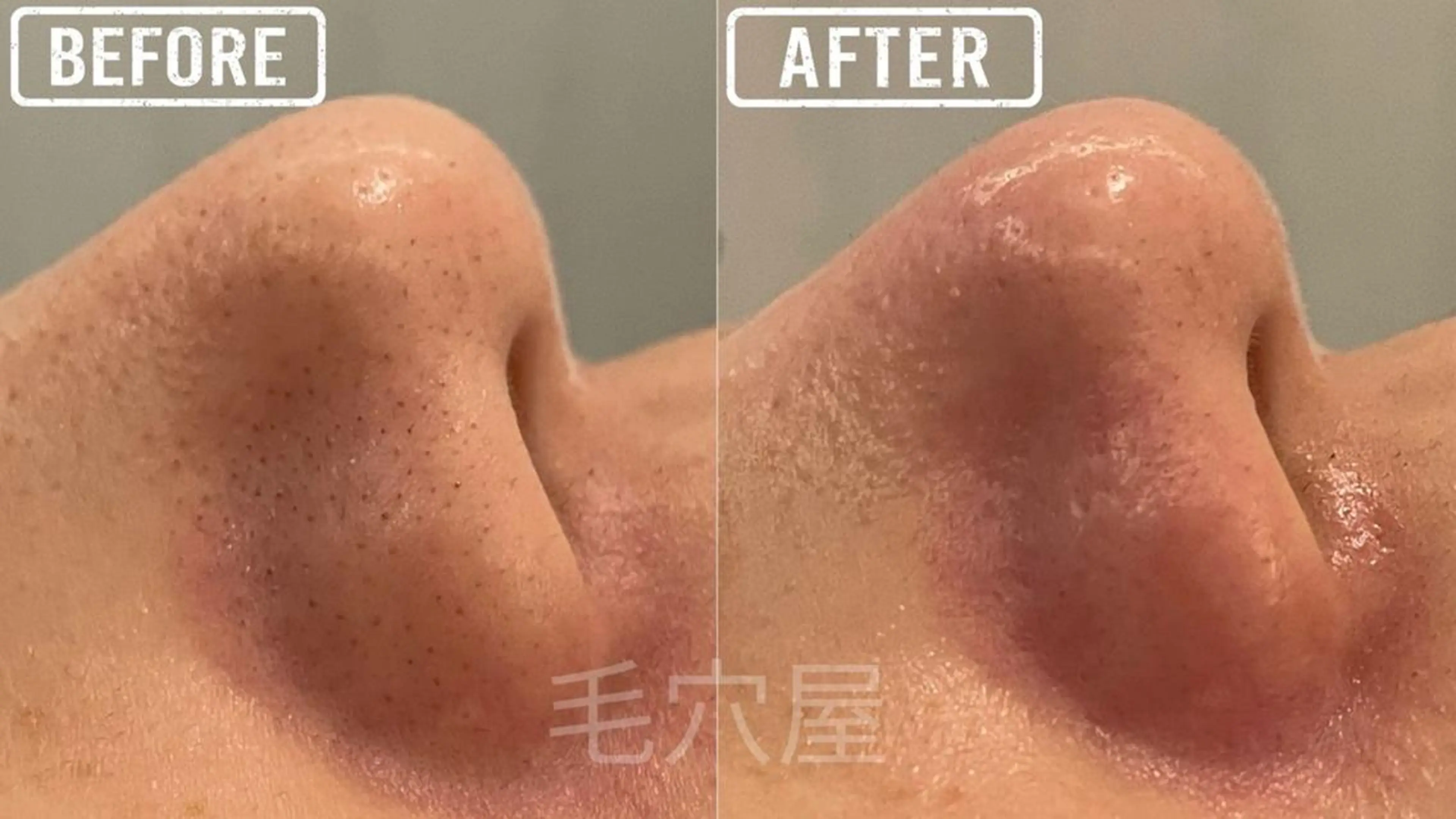 エステ 毛穴/毛穴洗浄専門 エミルカ船橋のエステ・リラクイメージ