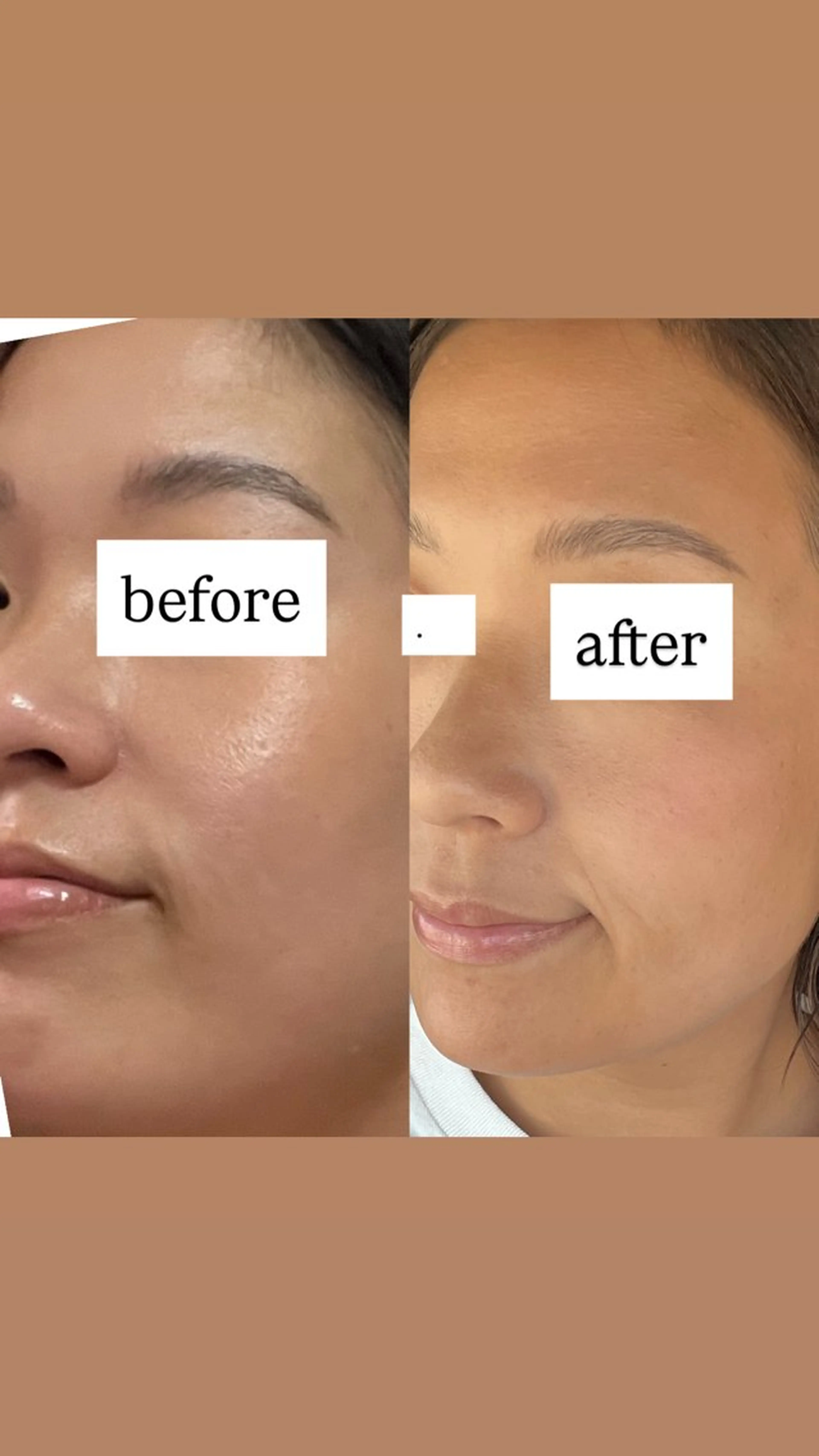 脱毛 iti所属・iti 眉毛とワックス脱毛の眉毛・アイブロウイメージ