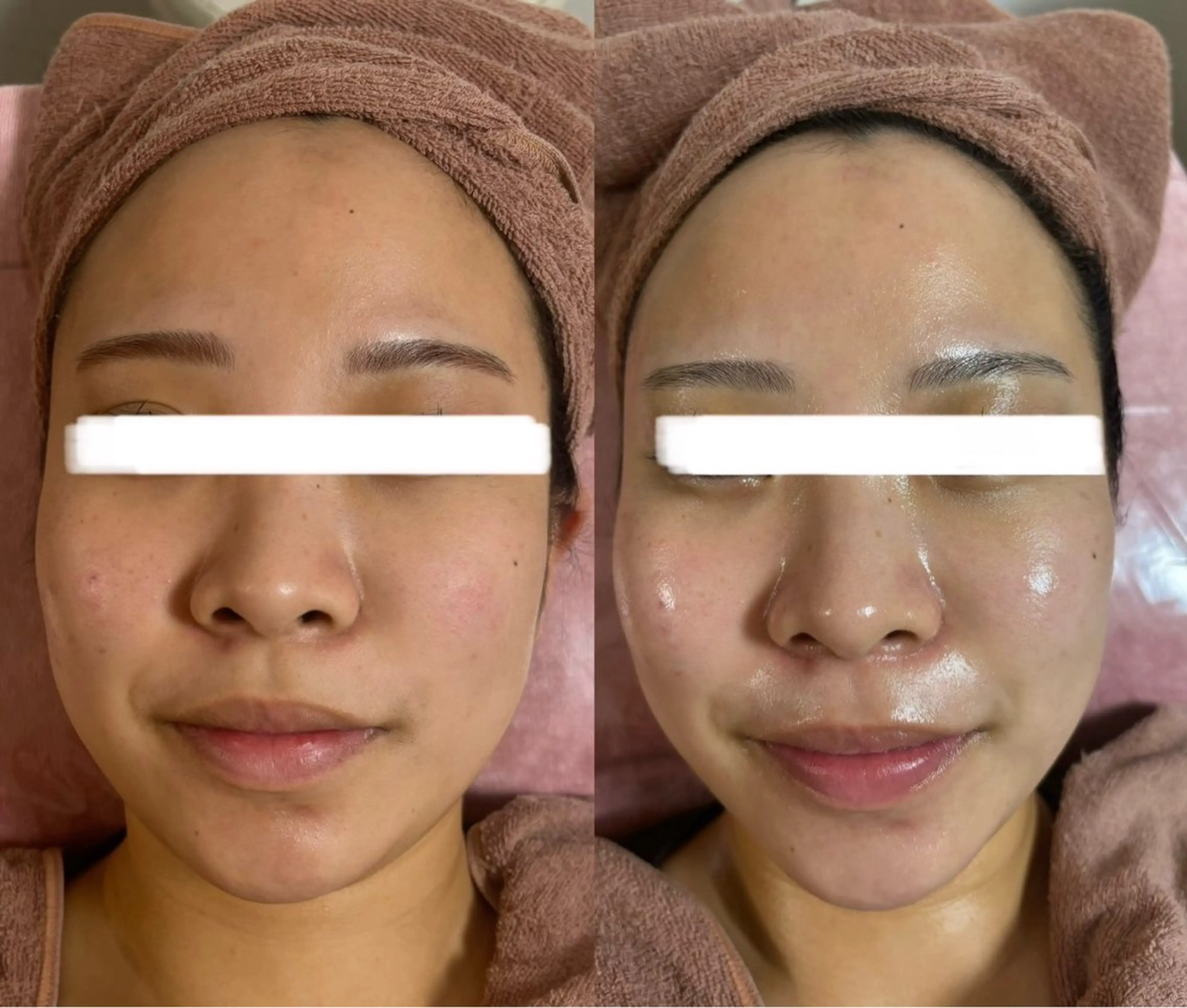 脱毛 透明感の肌Lino malieのエステ・リラクイメージ