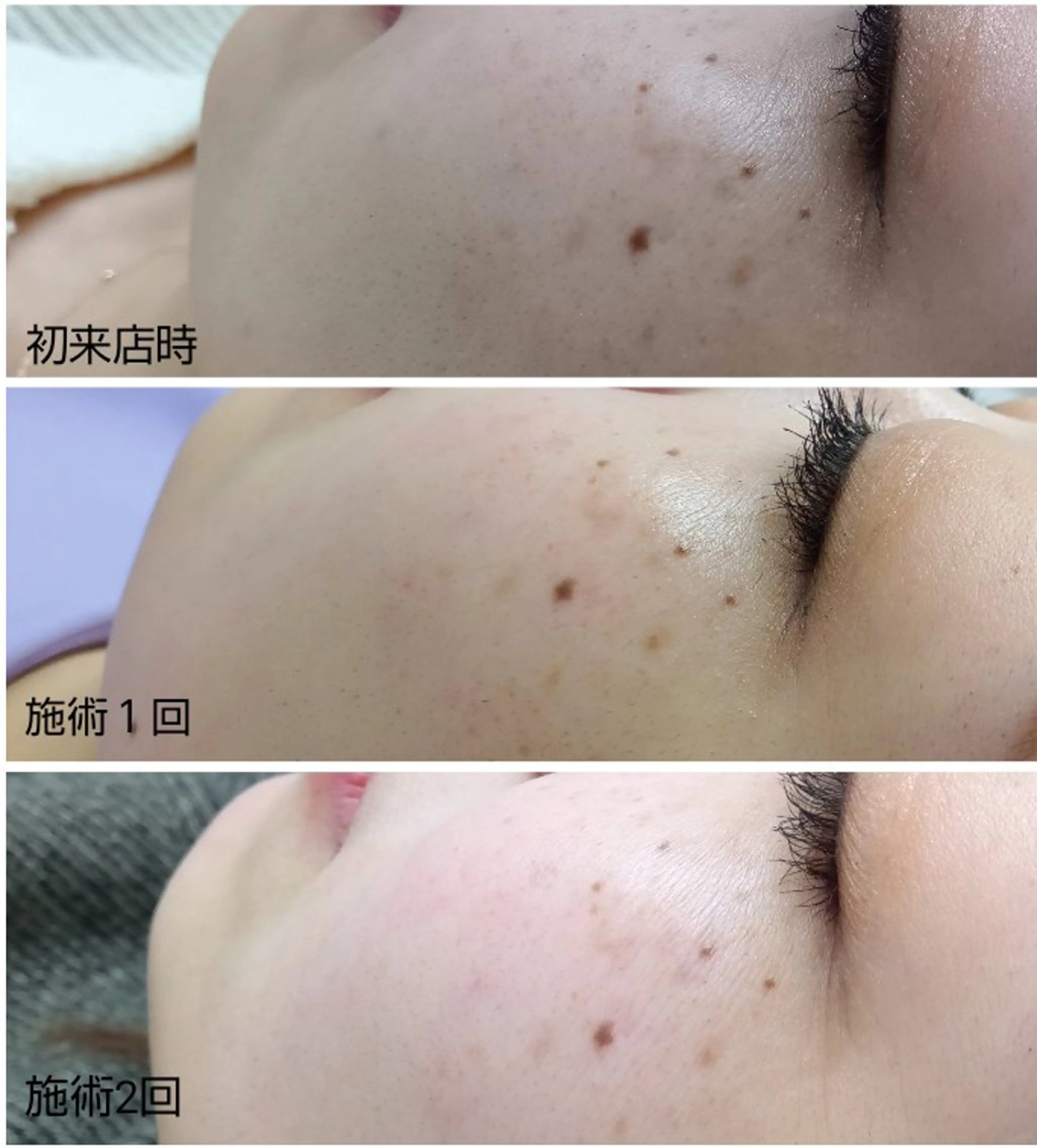 シミケア専門店 HAQUAのその他イメージ