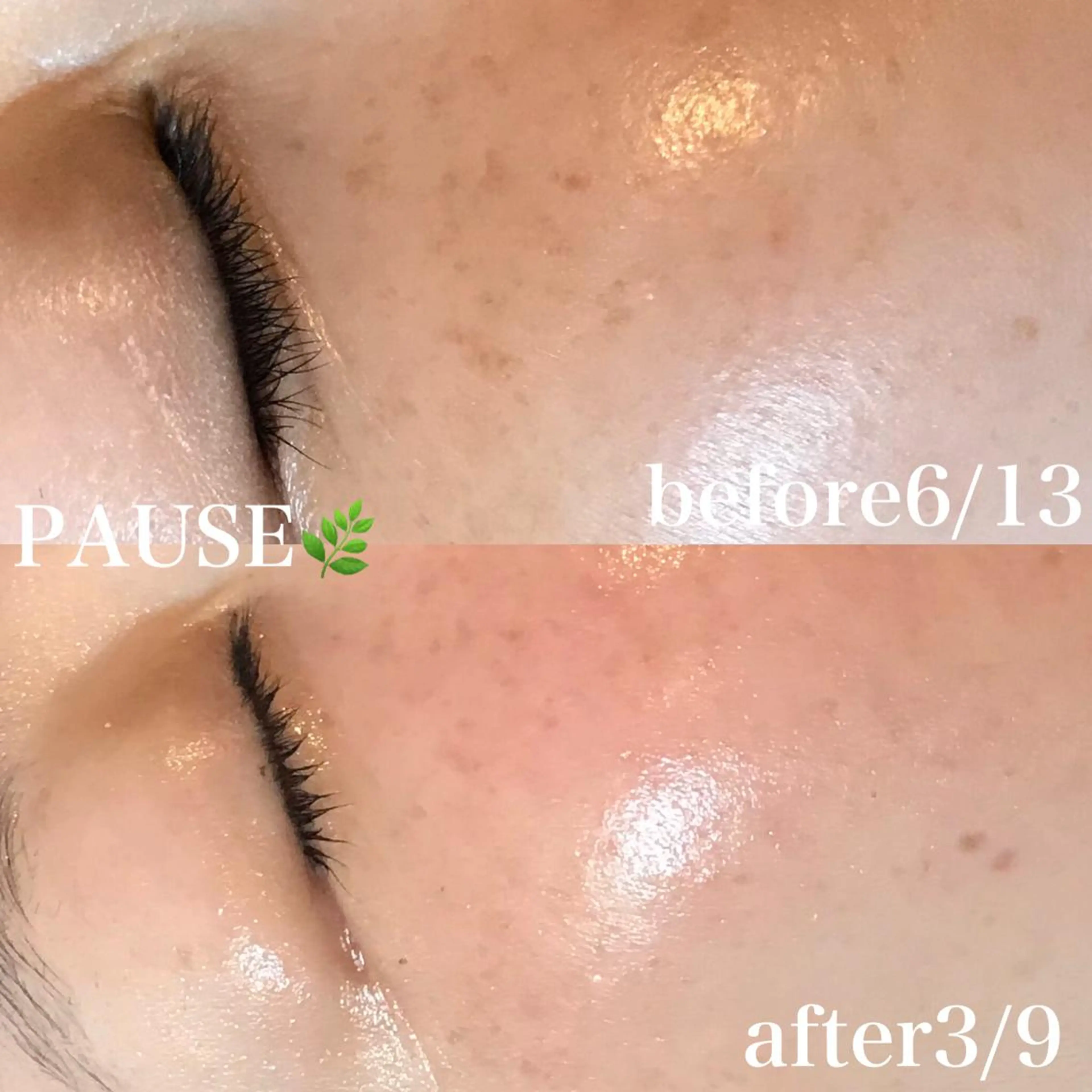 エステ 浜野 恵美のエステ・リラクイメージ