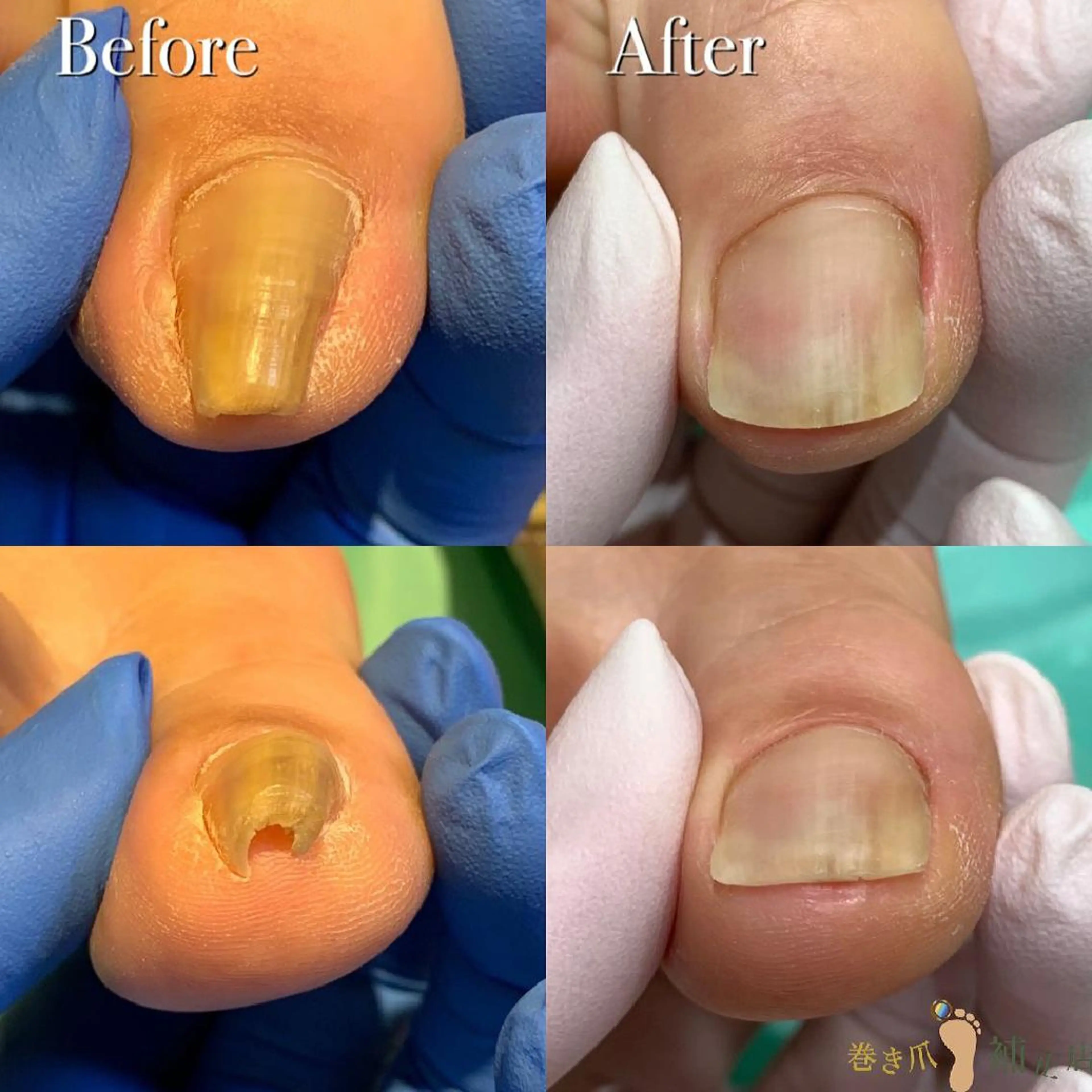 ネイル 東京巻き爪アカデミー所属・東京巻き爪 アカデミーのエステ・リラクイメージ