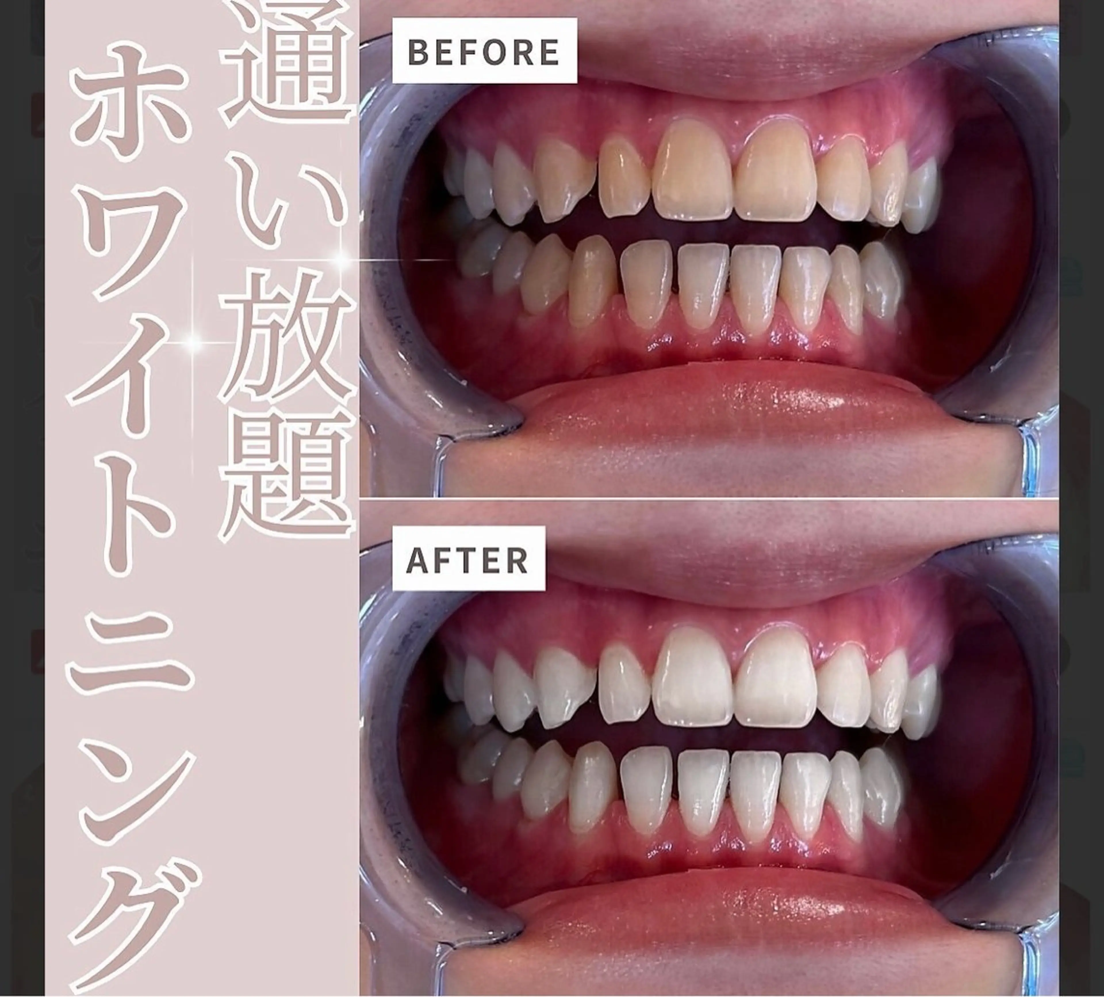 セルフホワイトニング エクシア盛岡中央通店所属・セルフホワイトニング エクシア盛岡あっくんのエステ・リラクイメージ